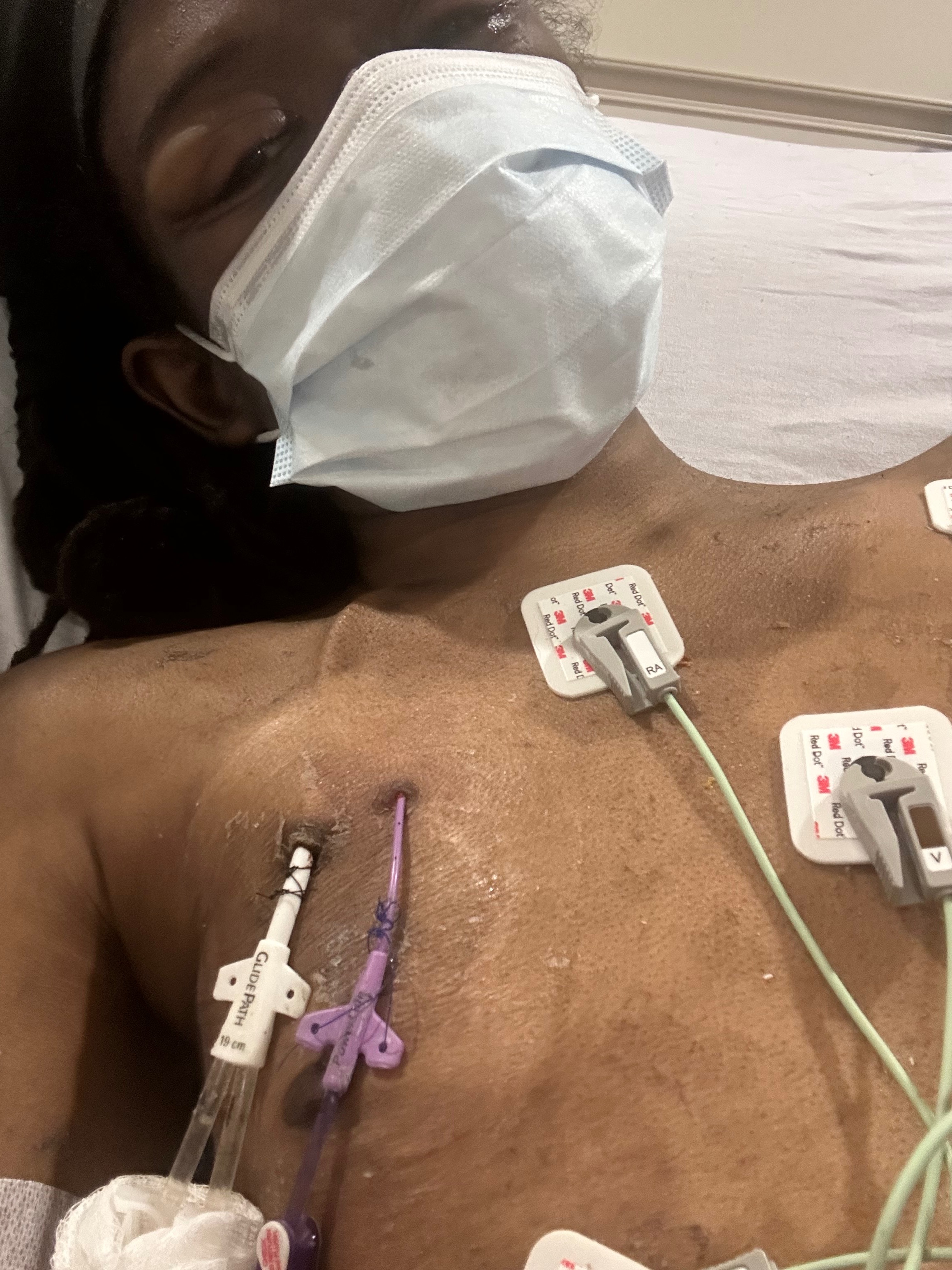 Help Antwoyn Prepare for His Kidney Transplant campaign photo, 2 of 7