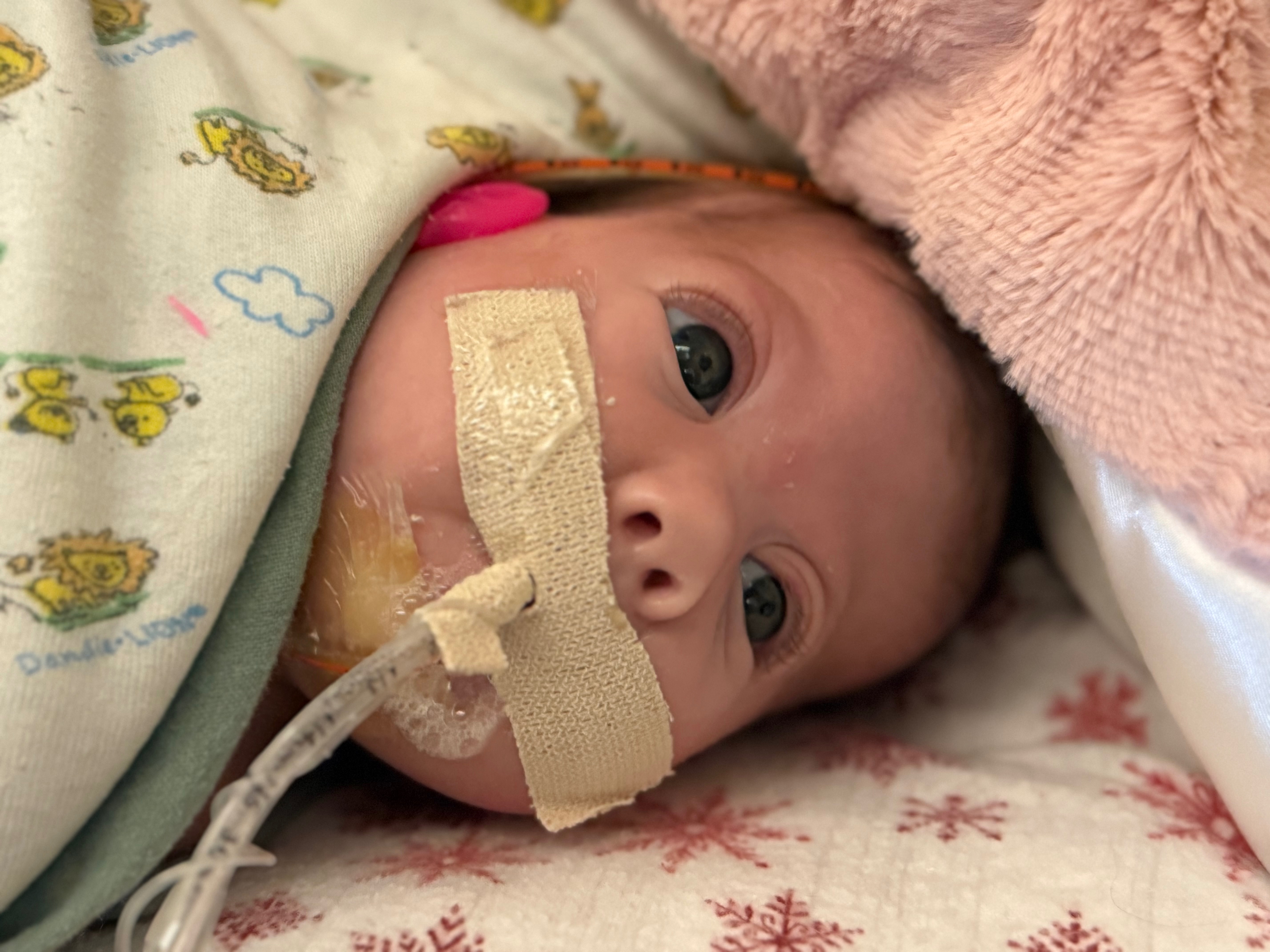 Support Baby Amelia's NICU Journey campaign photo, 4 of 8