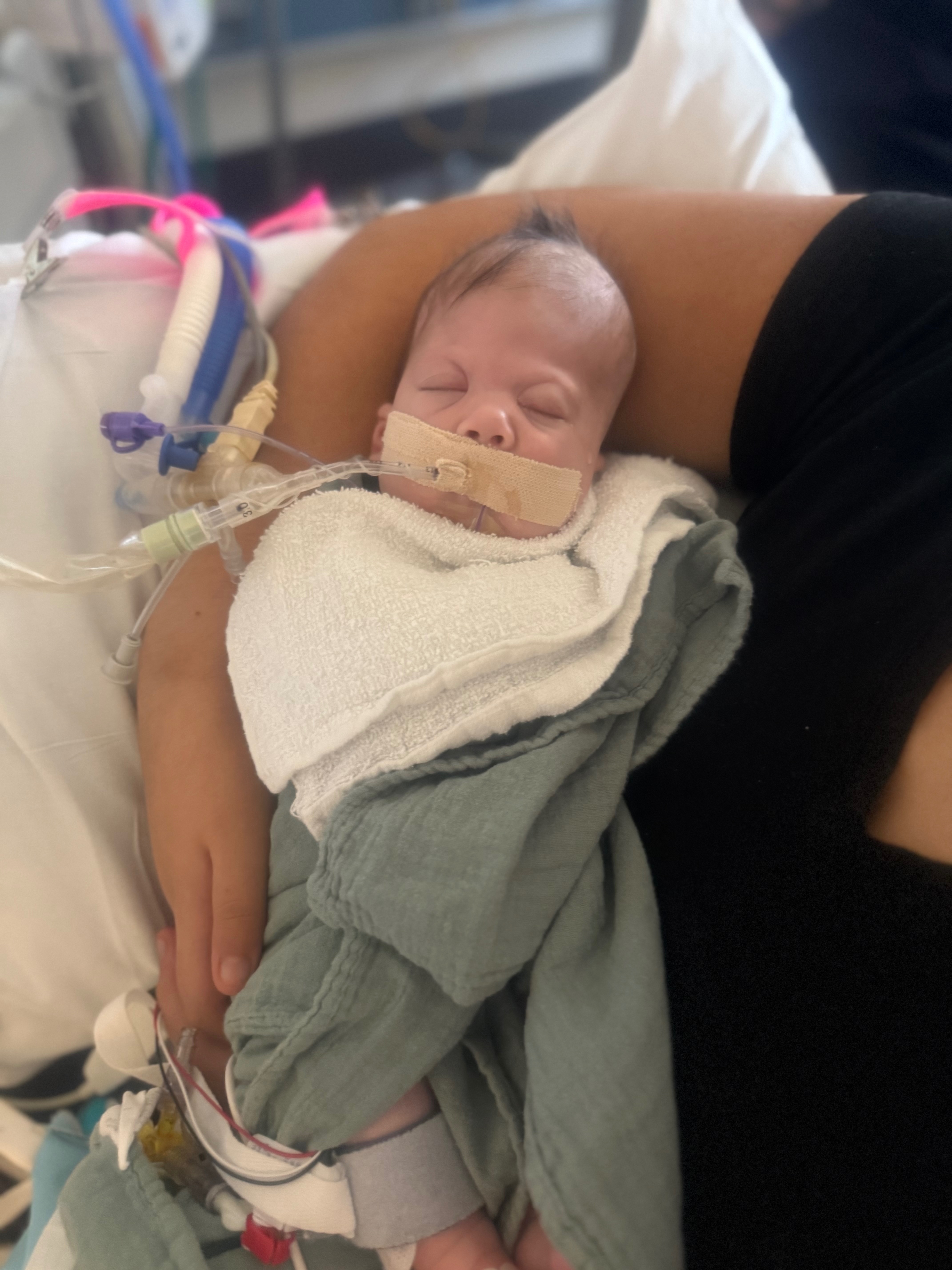 Support Baby Amelia's NICU Journey campaign photo, 2 of 8