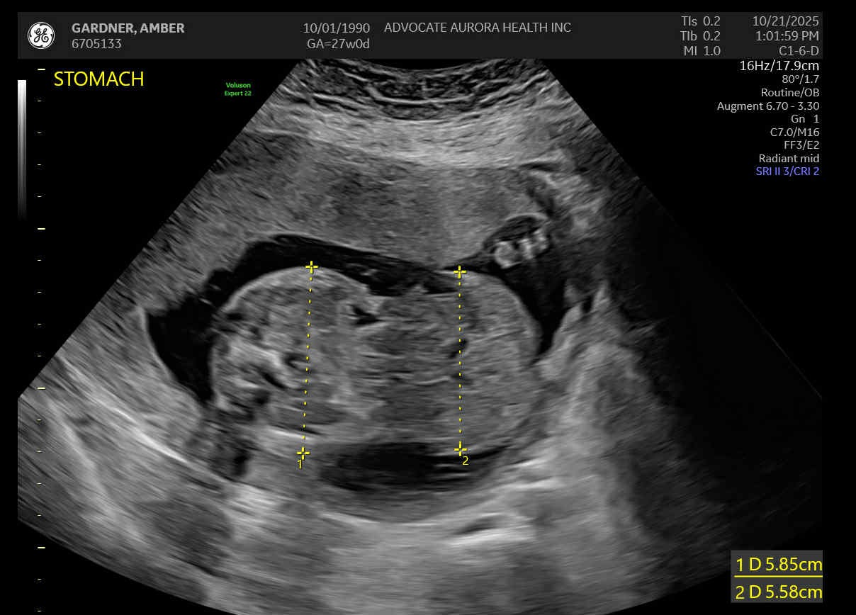 Support Baby Micah’s NICU Journey campaign photo, 4 of 6