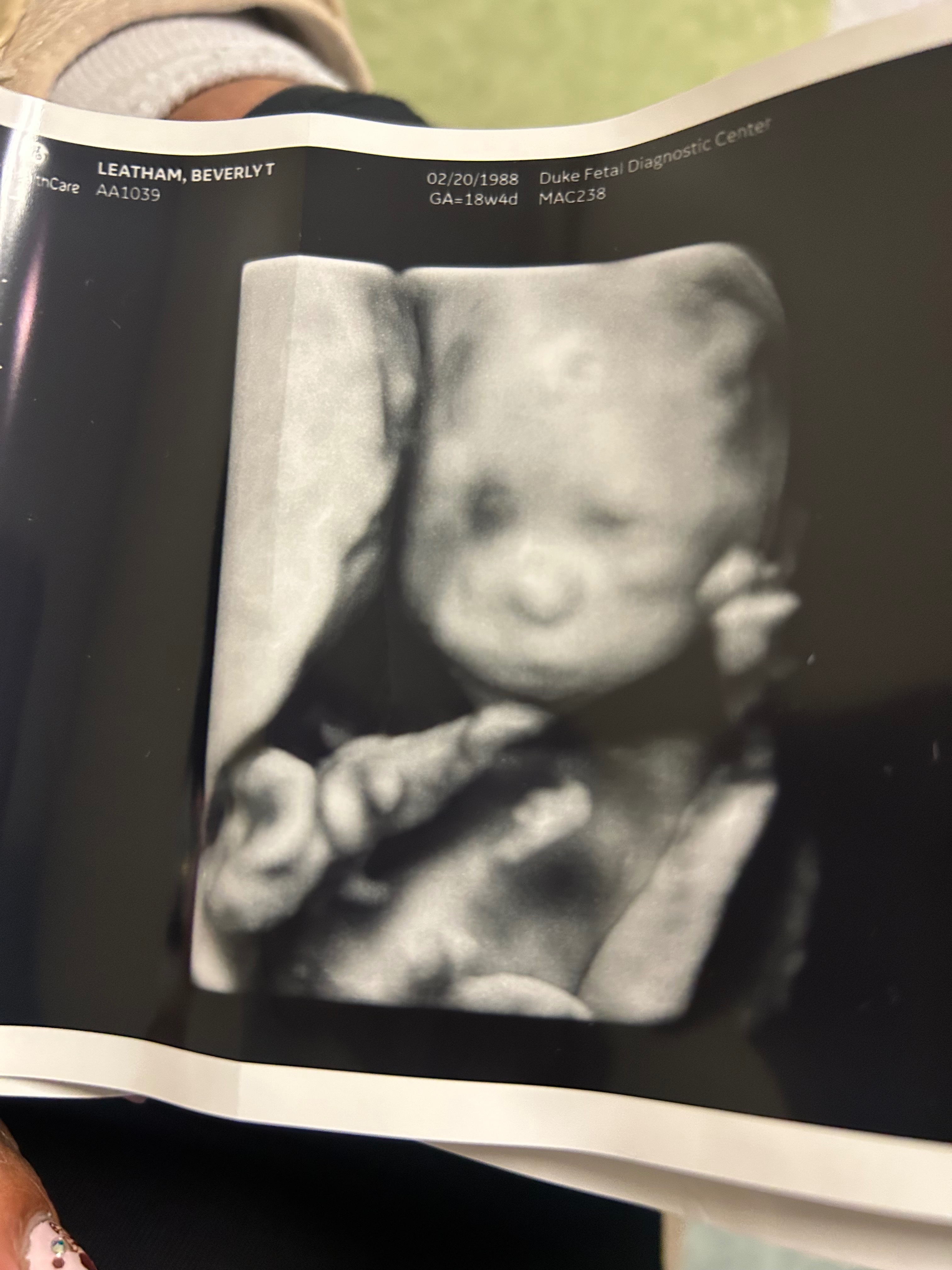 Support for Beverly’s High-Risk Pregnancy campaign photo, 2 of 4