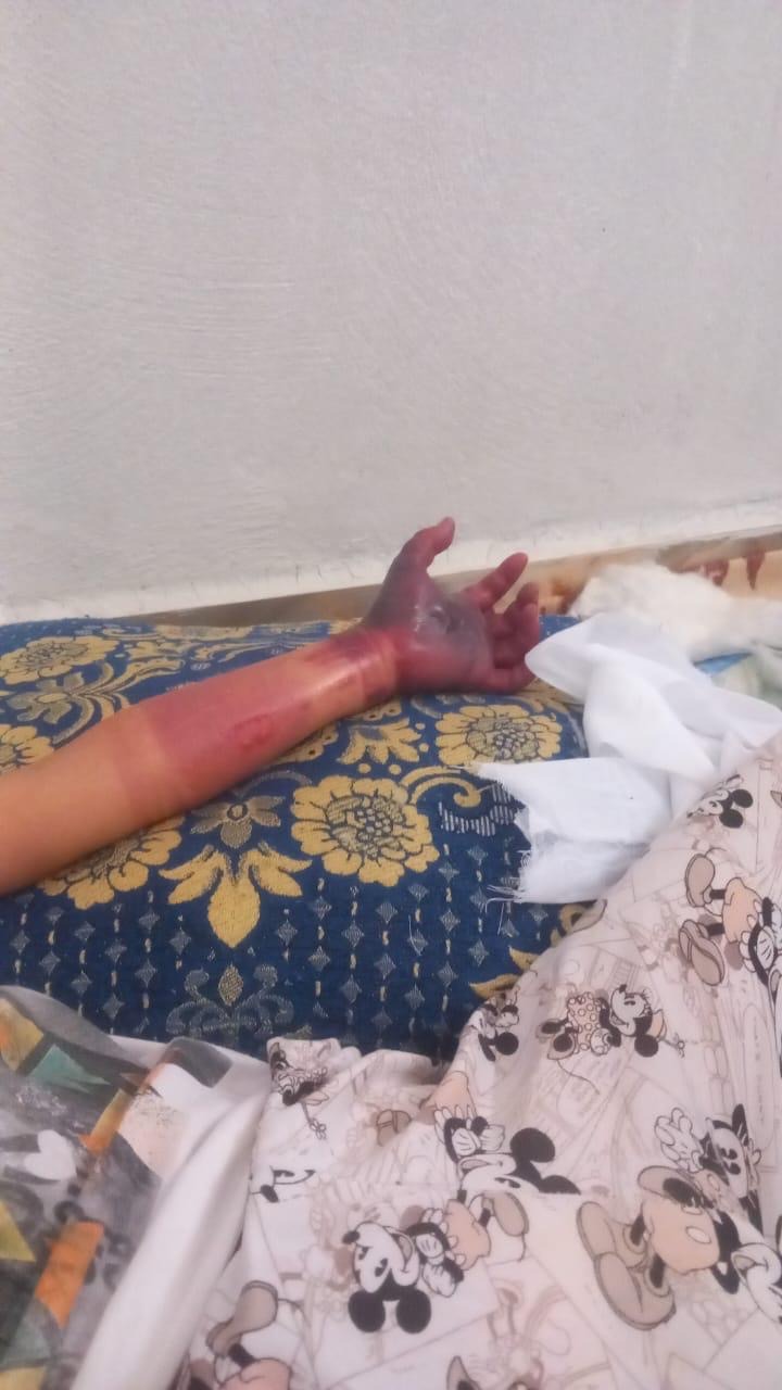 Help 9-Year-Old Hafsa Save the Feeling in Her Hand After Med campaign photo, 2 of 7