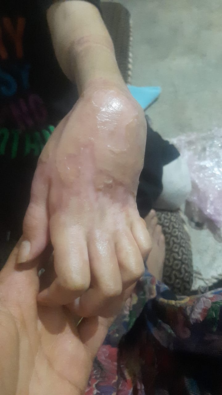 Help 9-Year-Old Hafsa Save the Feeling in Her Hand After Med campaign photo, 5 of 7