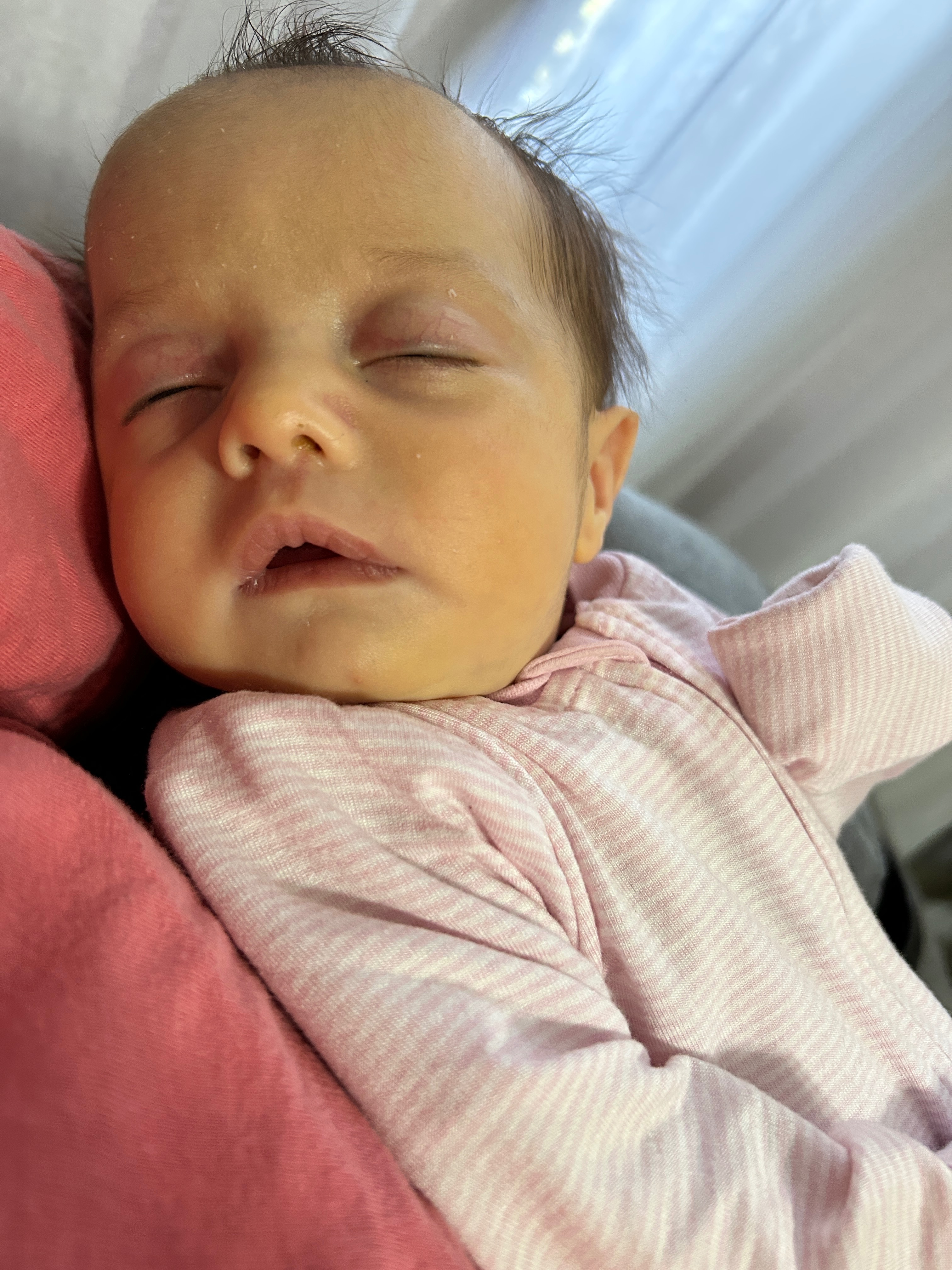 Support Oakley’s Heart Surgery Journey campaign photo, 2 of 8