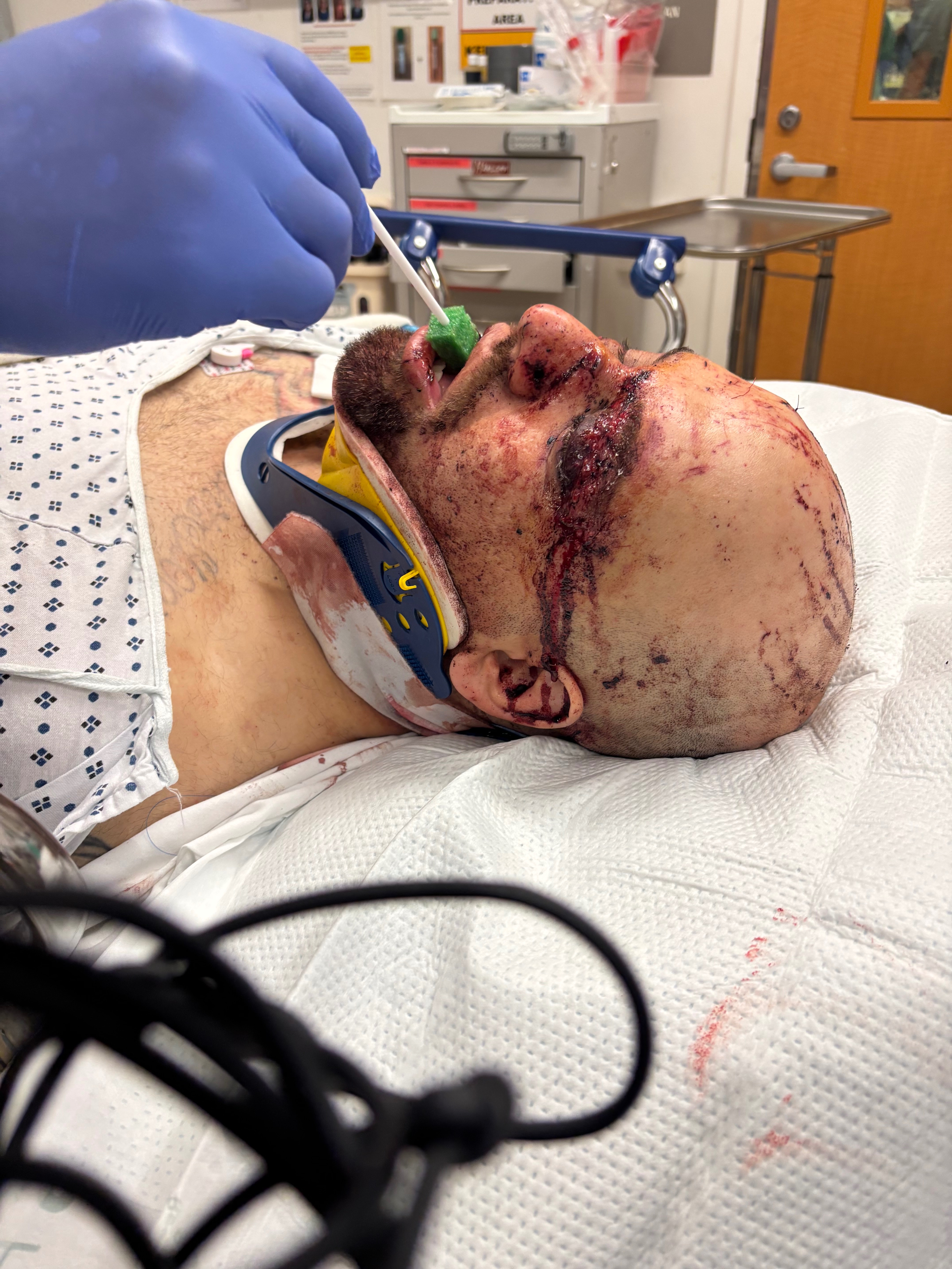 Help Jesus Heal from His Severe Injuries campaign photo, 2 of 4