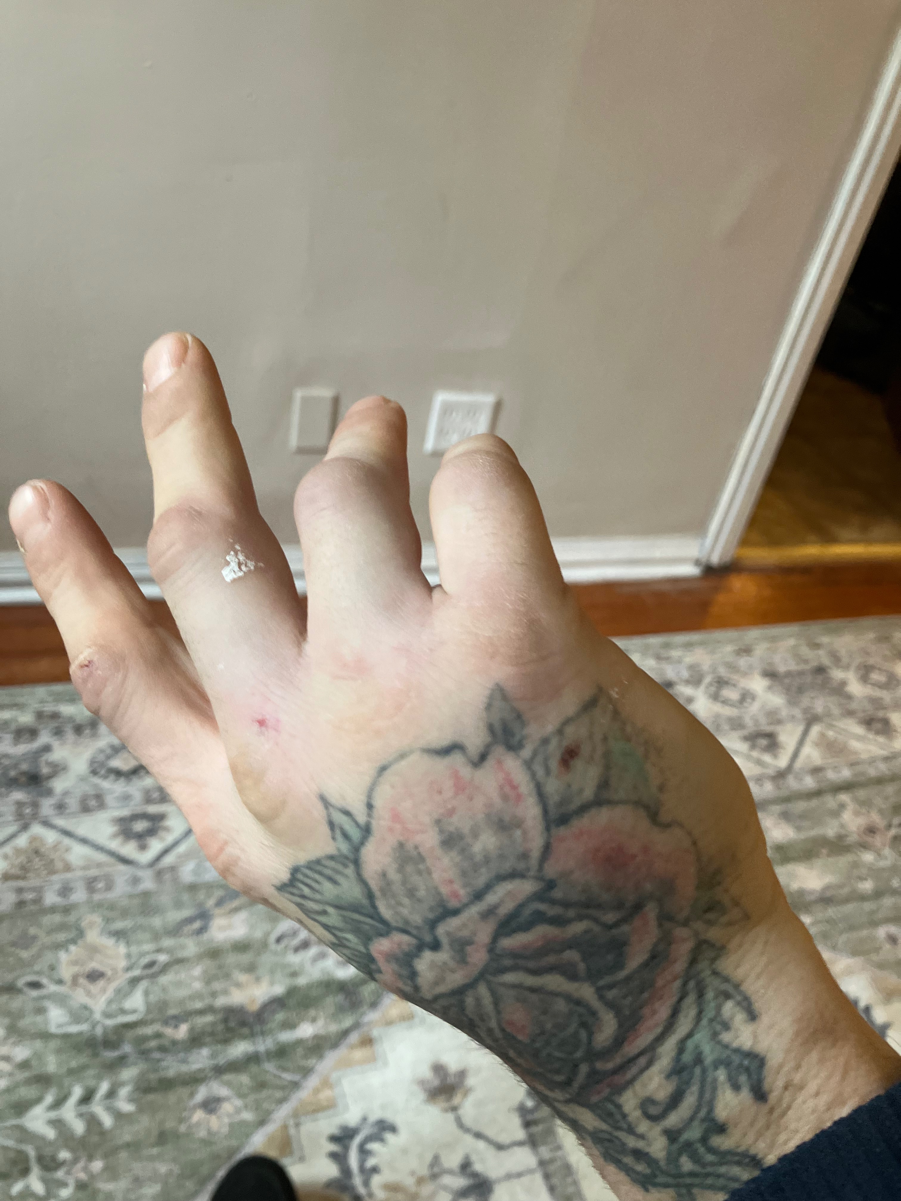 Support Andrew’s Recovery After Hand Injury campaign photo, 2 of 7