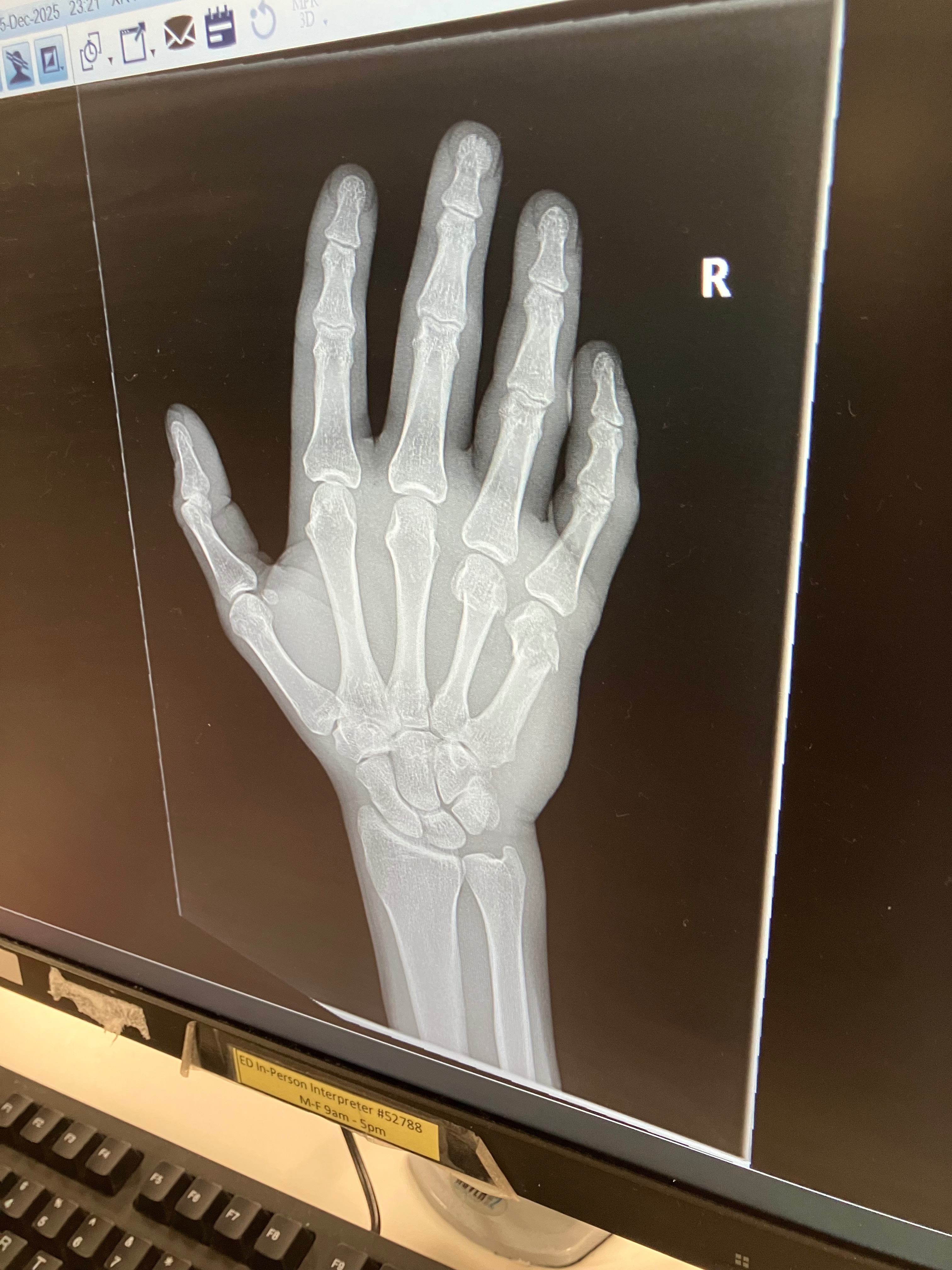 Support Andrew’s Recovery After Hand Injury campaign photo, 4 of 7