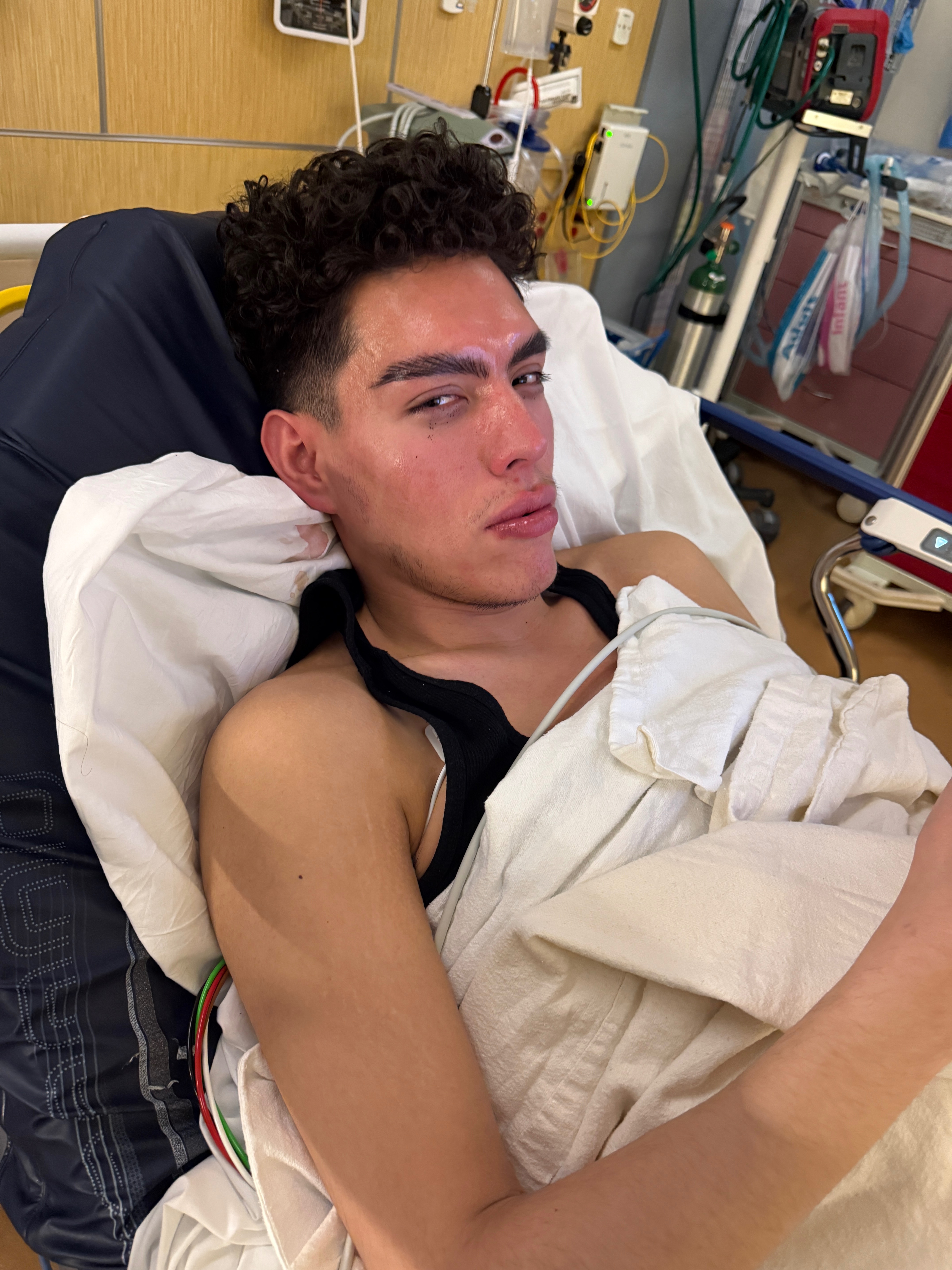 Help Hex Recover After Hit-and-Run campaign photo, 2 of 3