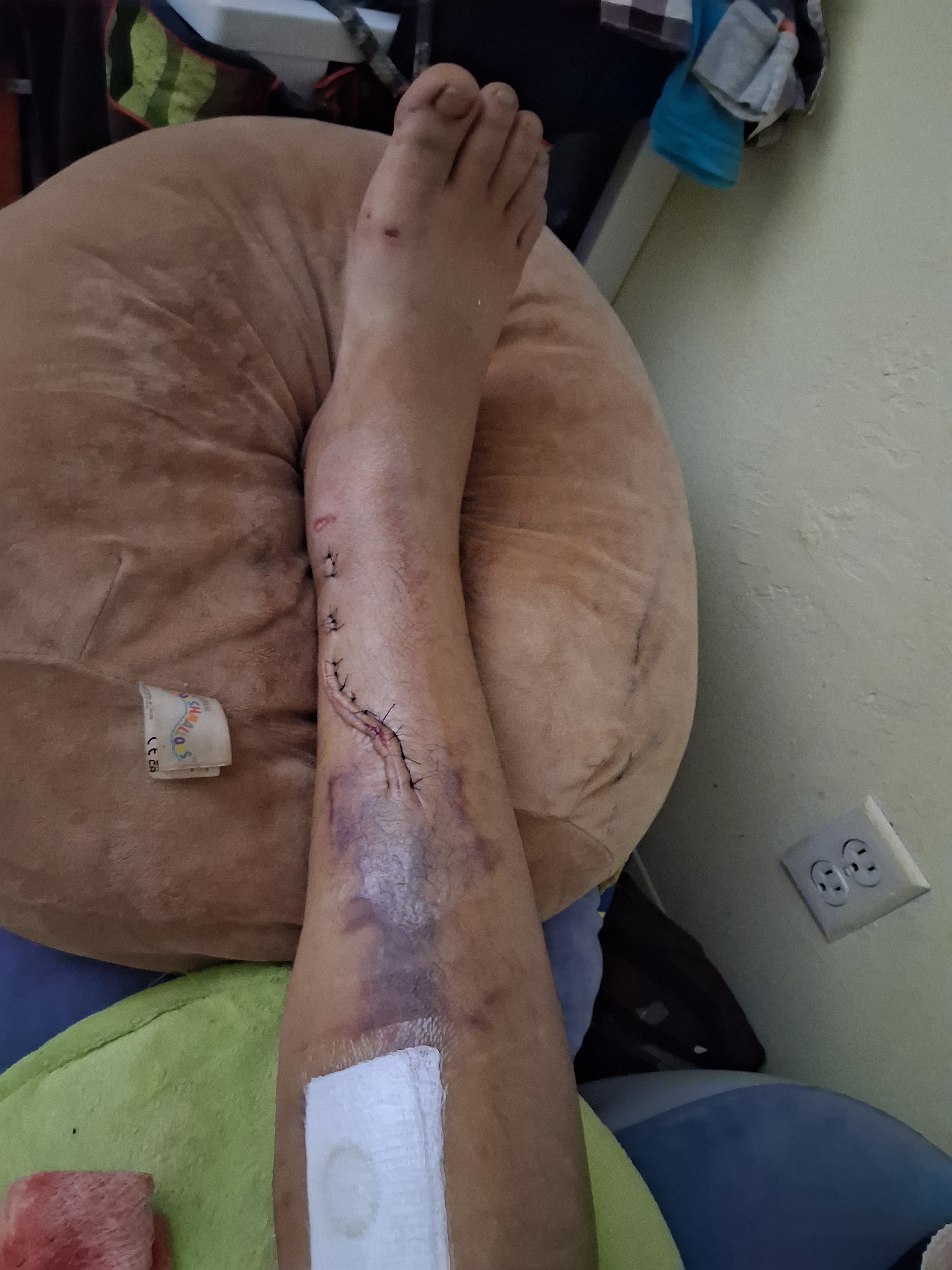 Help Hit and Run survivor Katherine pay ambulance campaign photo, 4 of 8