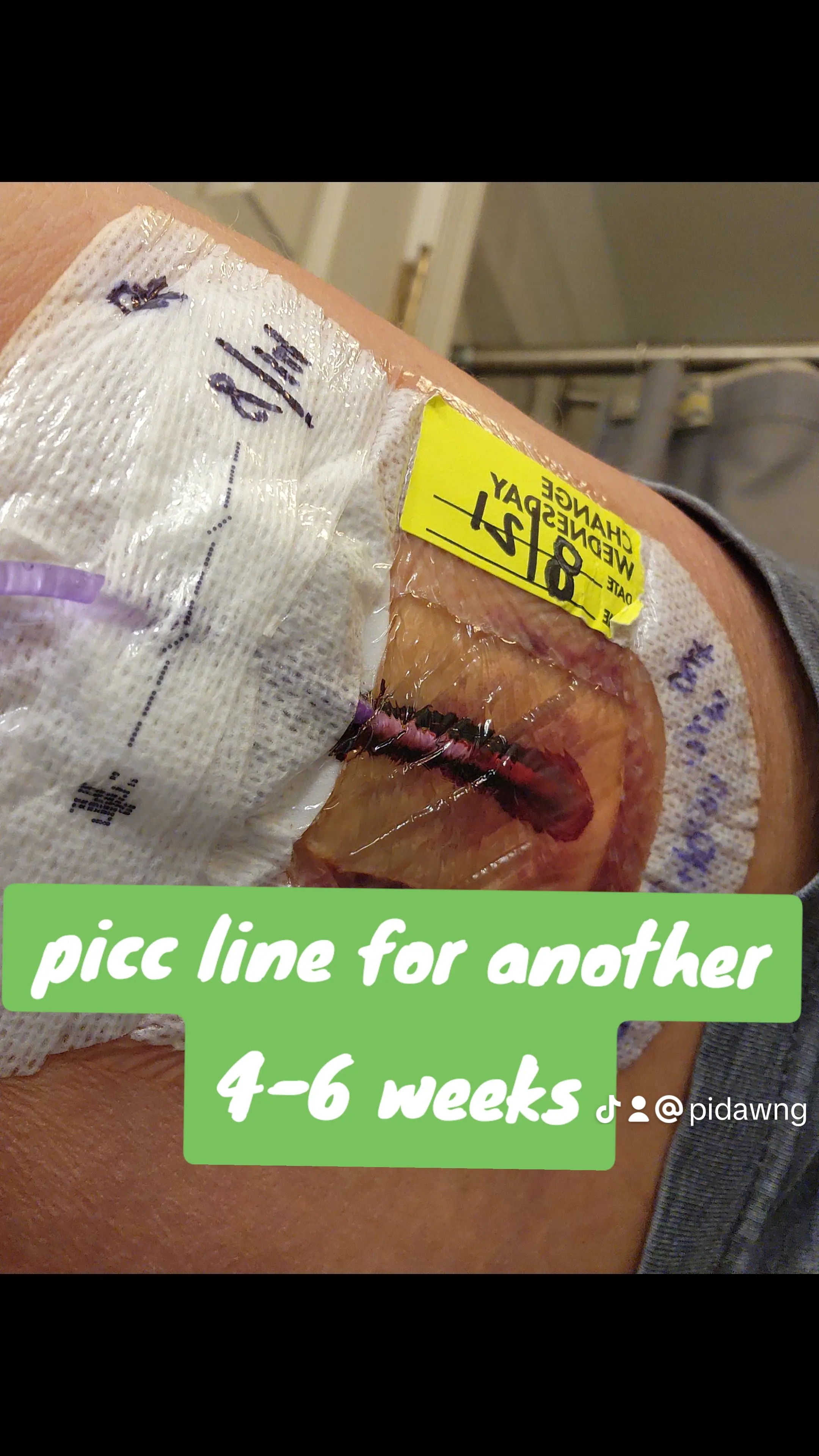 Standing with Dawn Through Her Medical Journey campaign photo, 7 of 8