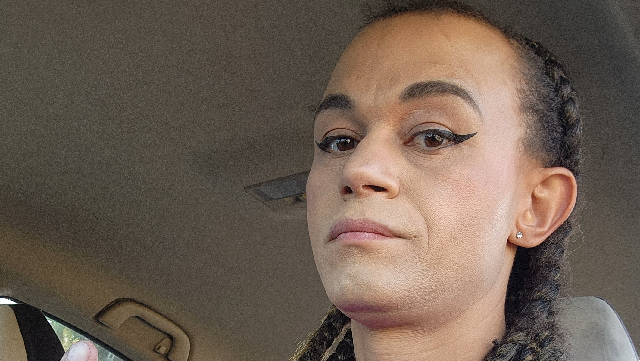 Support Raven's Facial Feminization Surgery Journey photo
