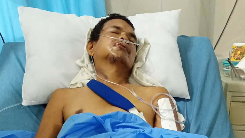 Tragic accident need financial photo