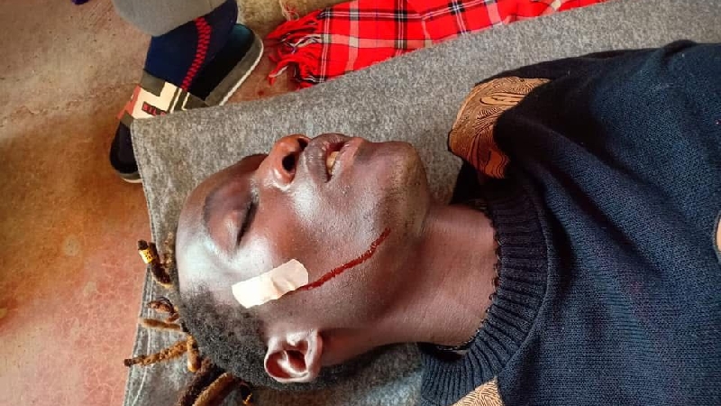 Help Kayemba Get Surgery in Nairobi photo