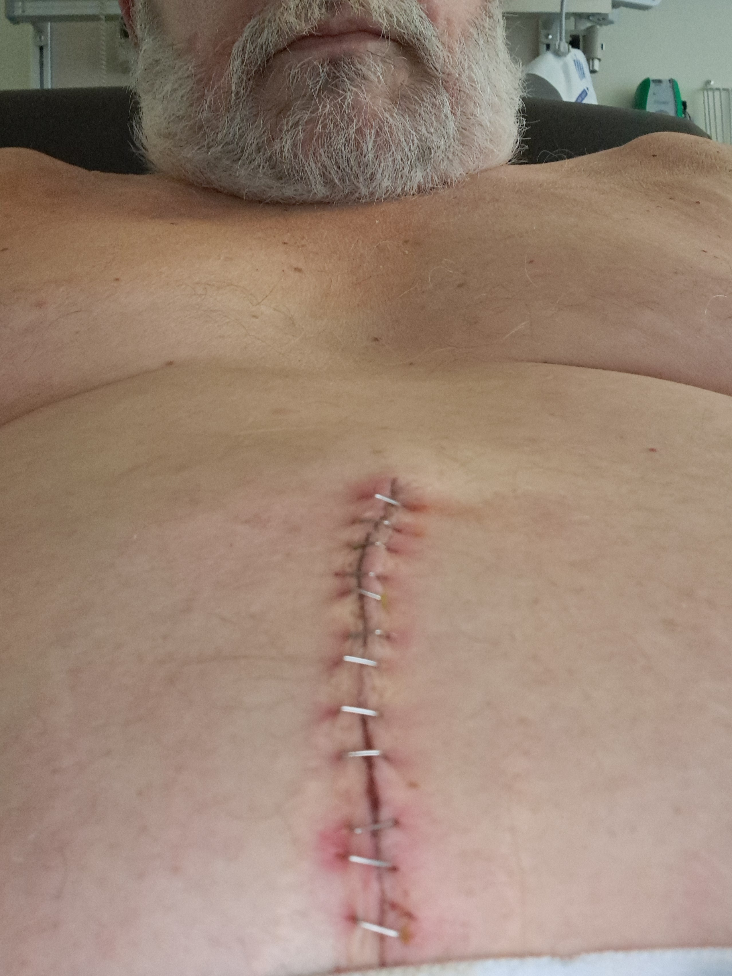 Help Glenn Find Stability During Cancer Battle campaign photo, 4 of 5