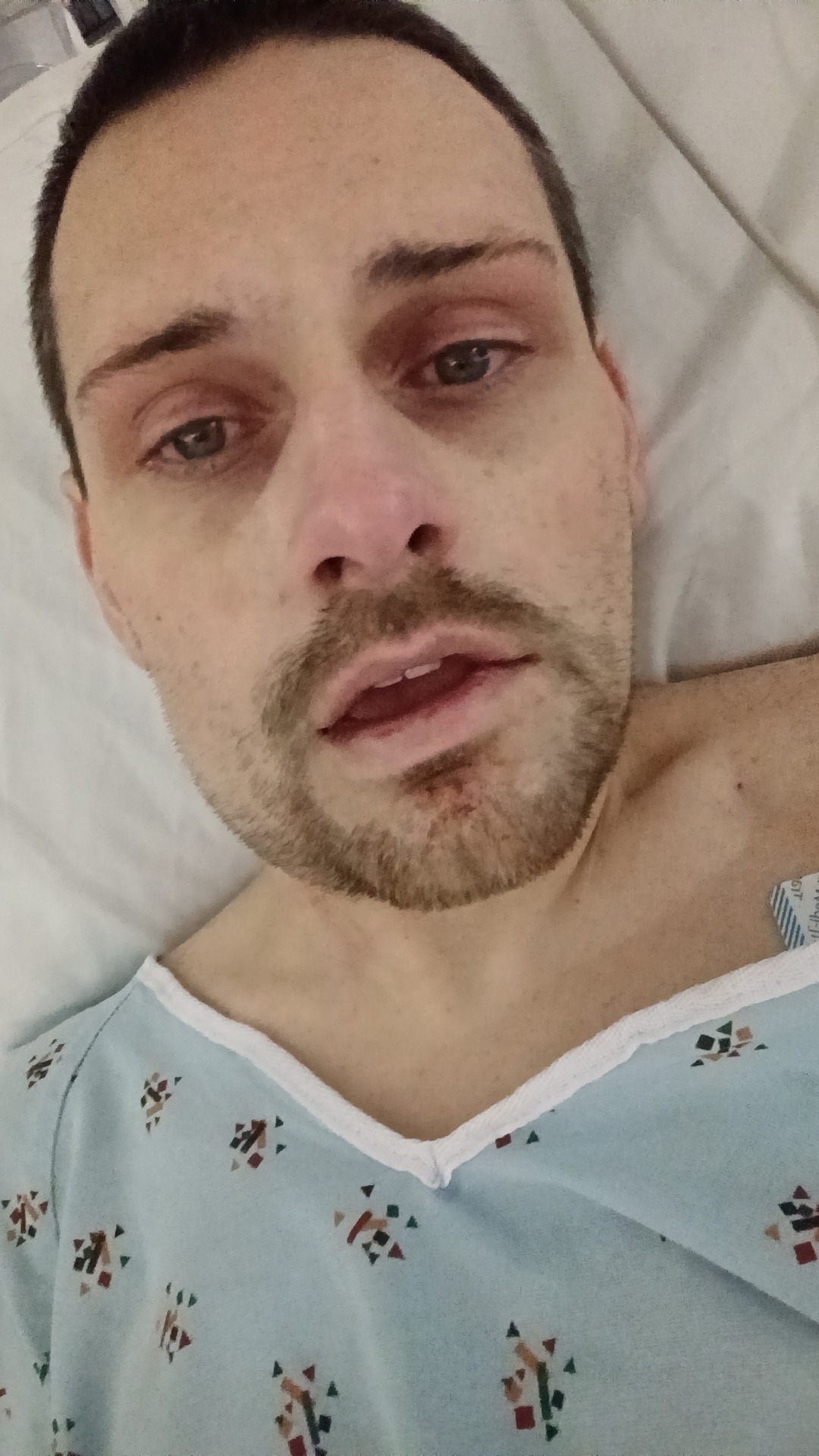 Support My Healing Journey After Jaw Surgery campaign photo, 6 of 7