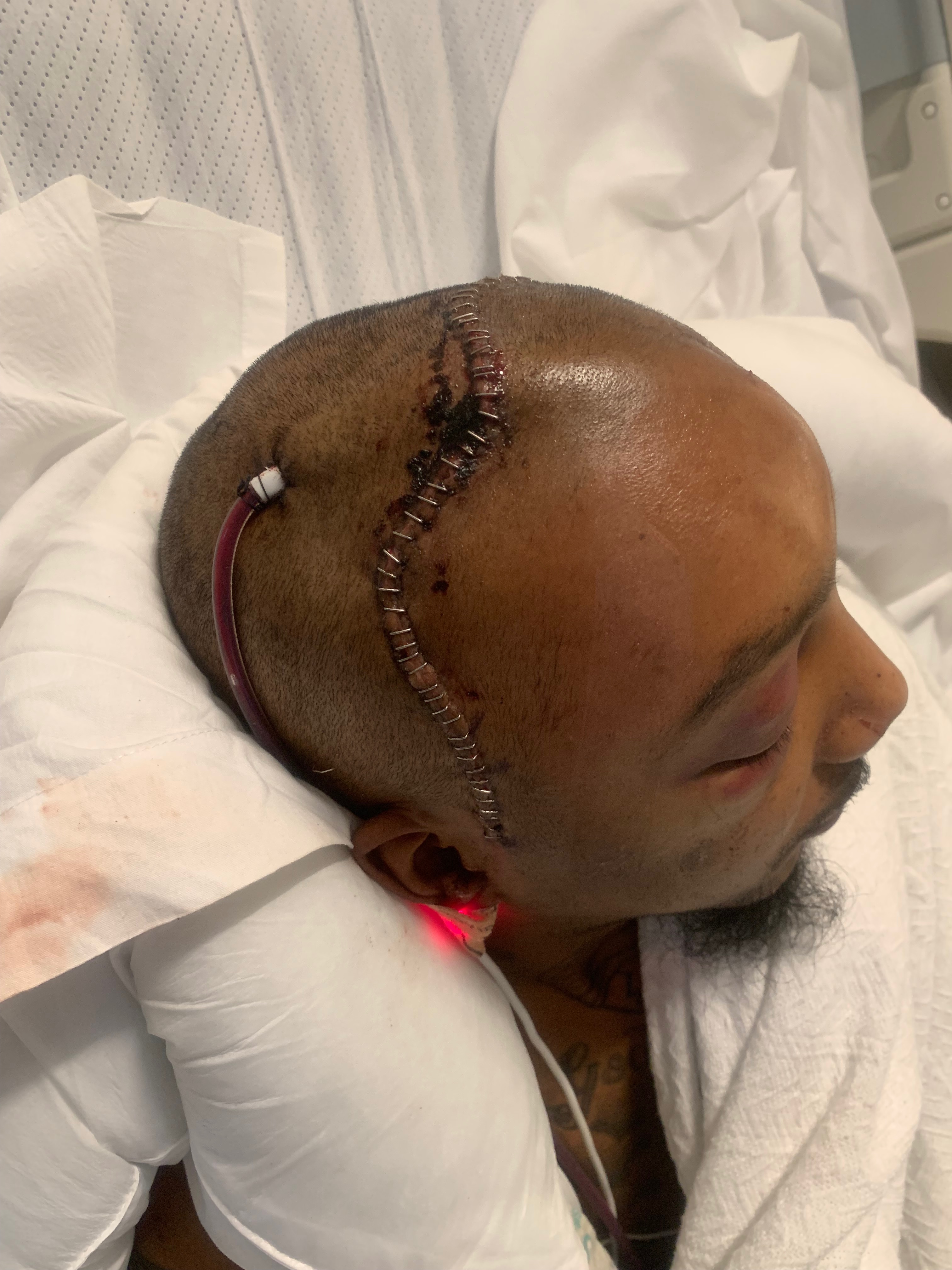 Help LaVon On His Long Road To Recovery campaign photo, 6 of 7