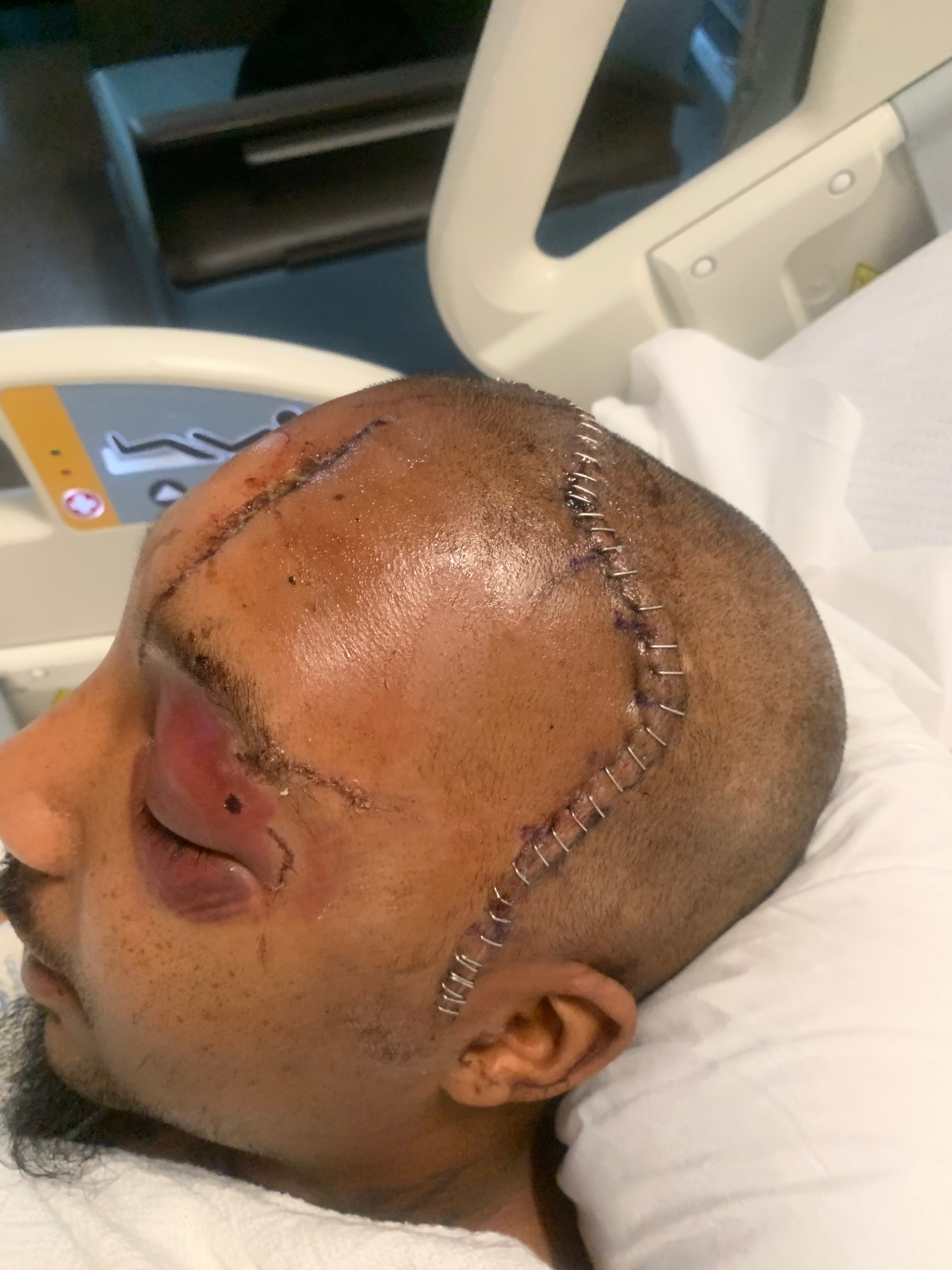 Help LaVon On His Long Road To Recovery campaign photo, 2 of 7