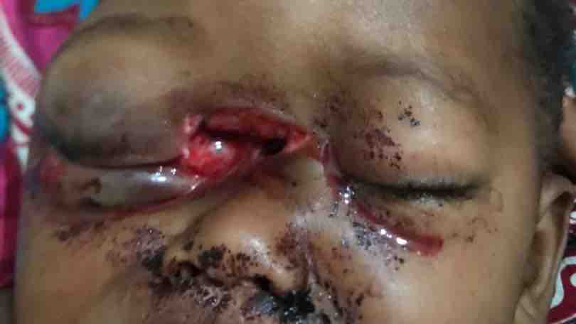 Urgent Surgery for a Young Boy's Recovery photo