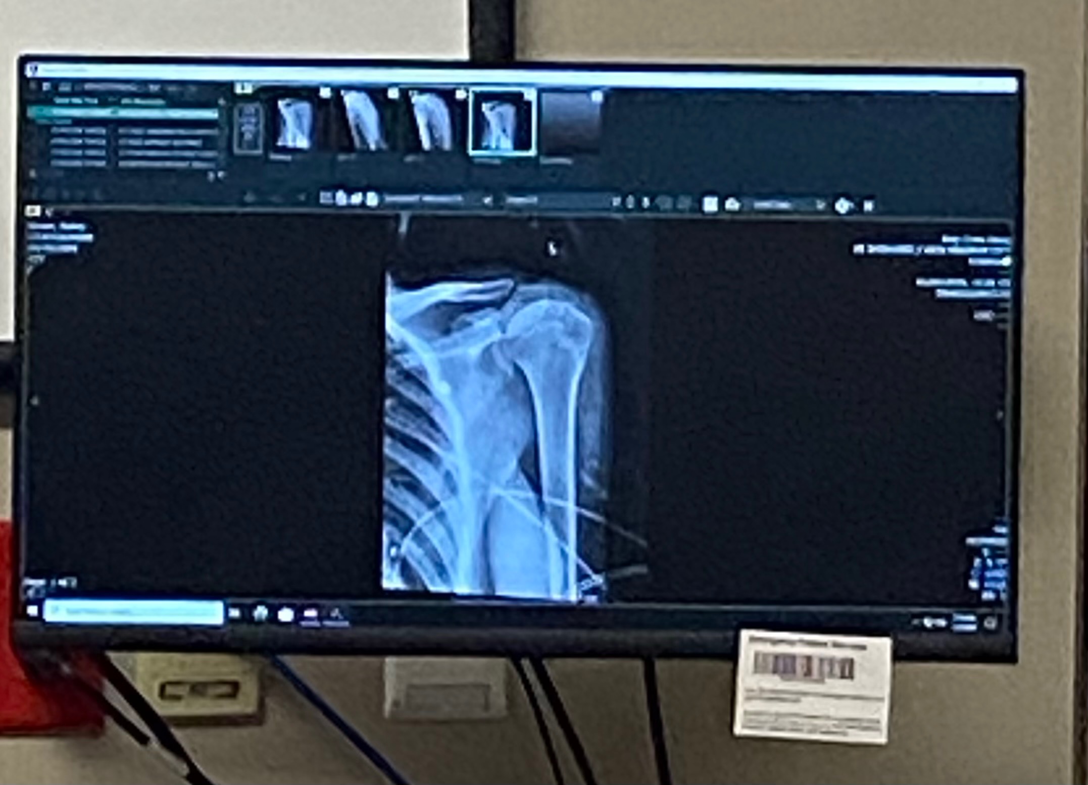 Help My Sweet Bailey Recover After Car Accident campaign photo, 6 of 7