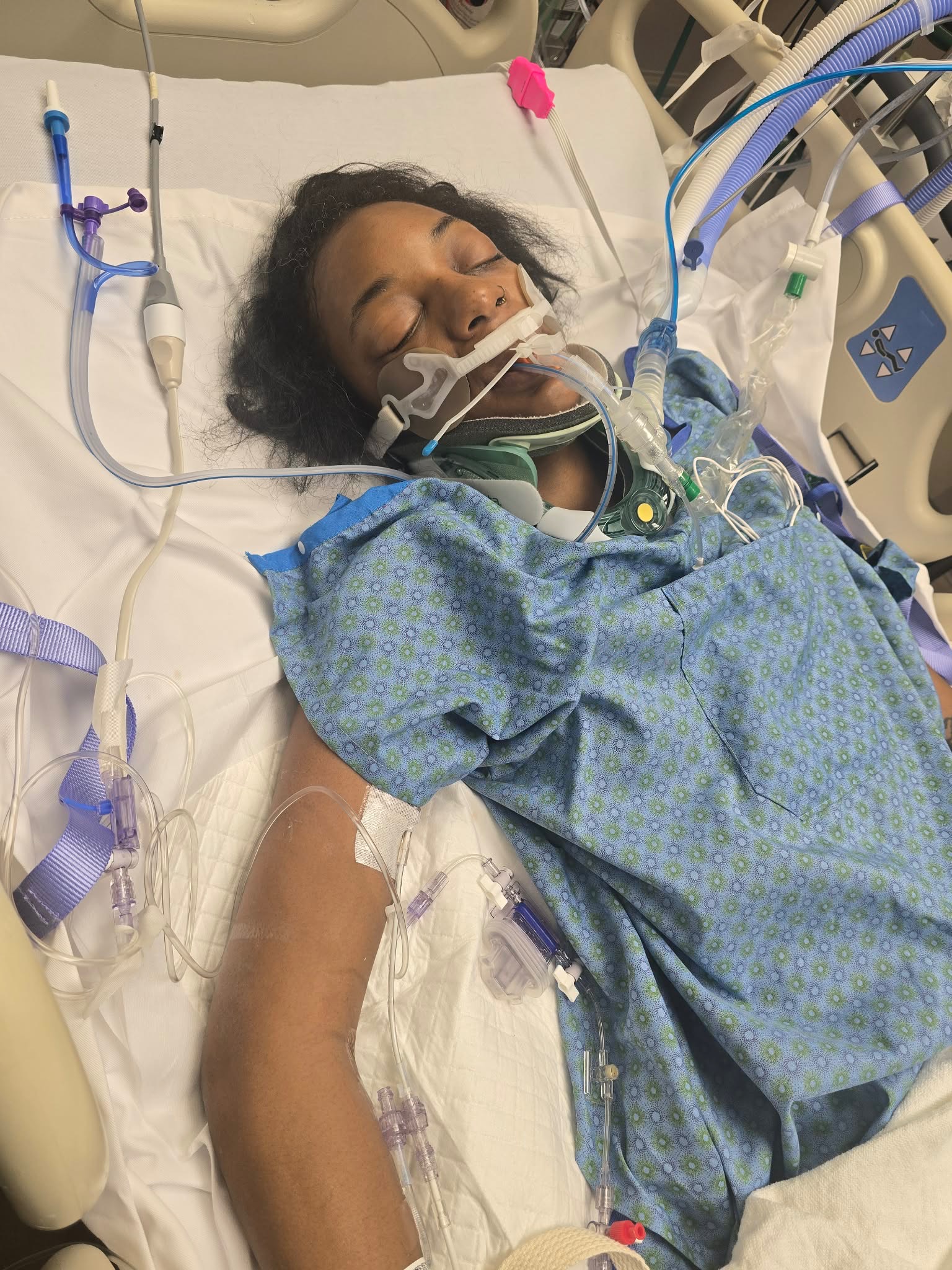 Help Our Sister After Tragic Accident campaign photo, 2 of 8