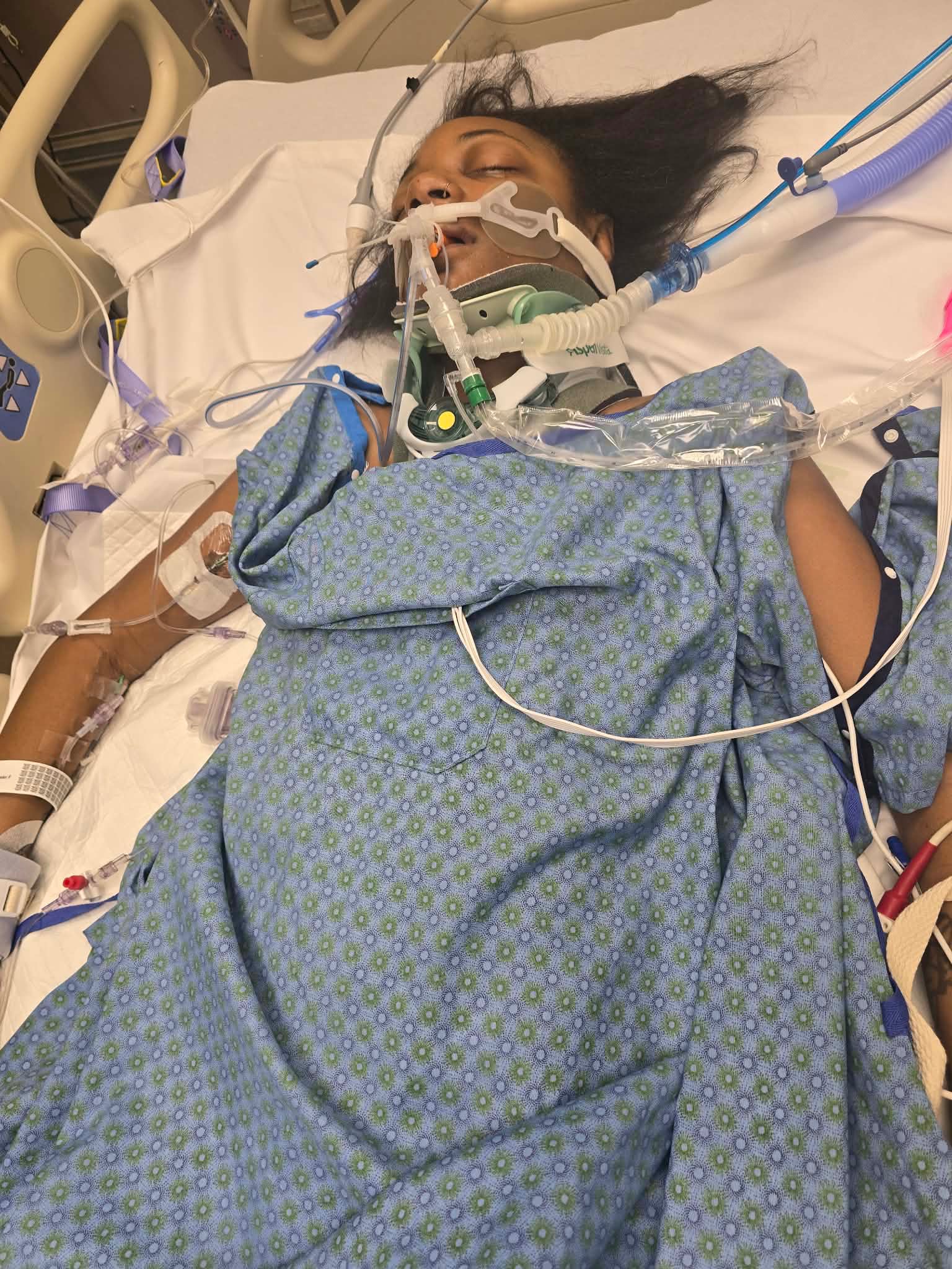 Help Our Sister After Tragic Accident campaign photo, 7 of 8