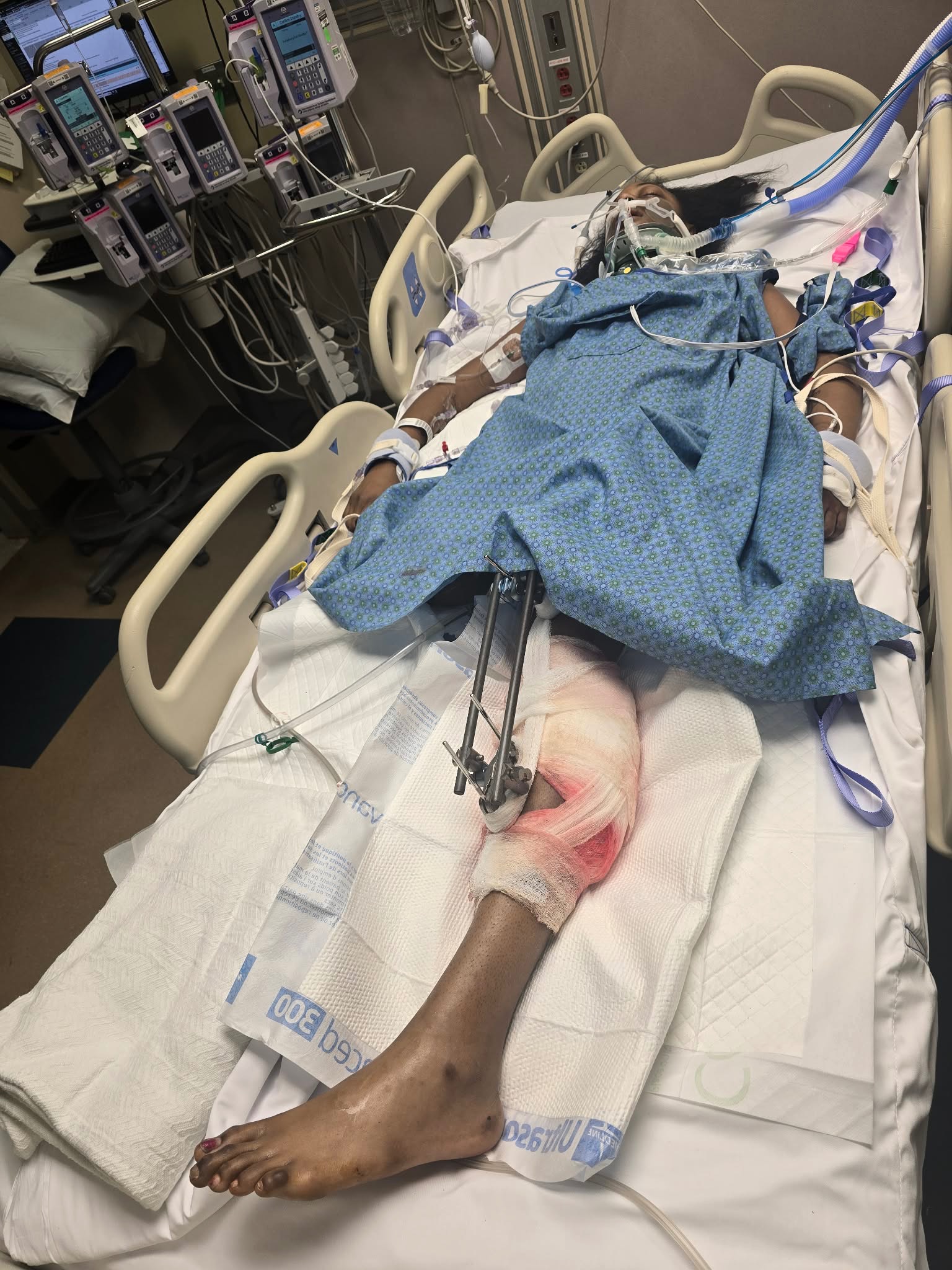 Help Our Sister After Tragic Accident campaign photo, 4 of 8