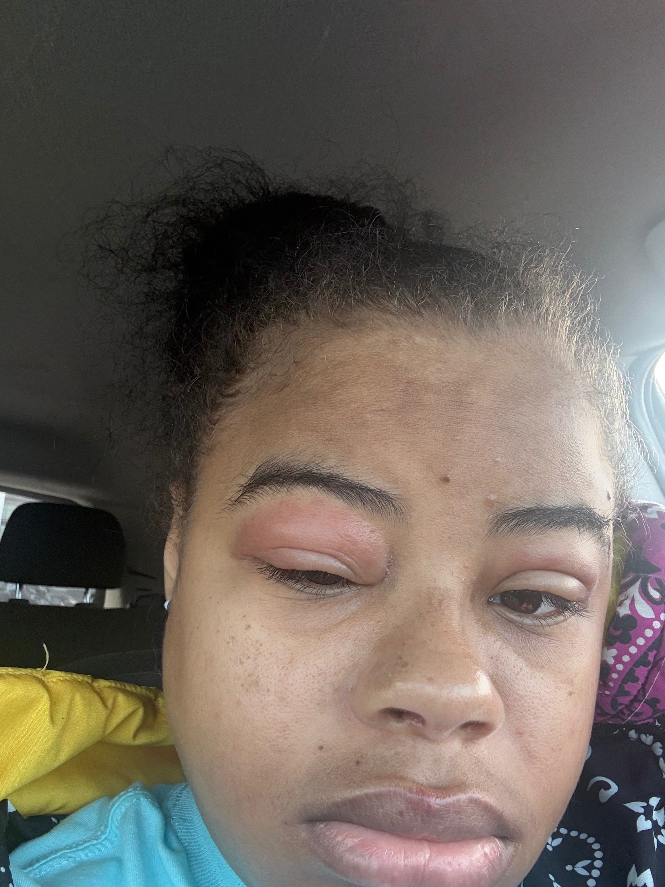 Help Diamond in Her Battle with Lupus campaign photo, 4 of 7