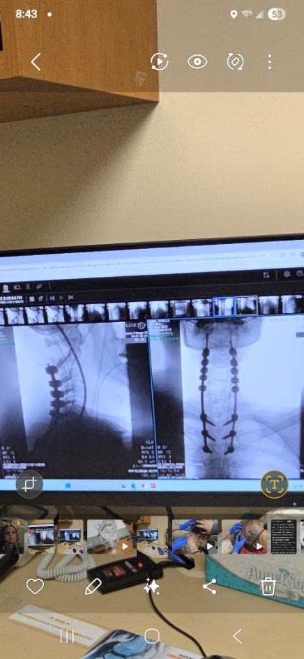 Support Pam’s Recovery from Major Spine Surgery campaign photo, 4 of 7