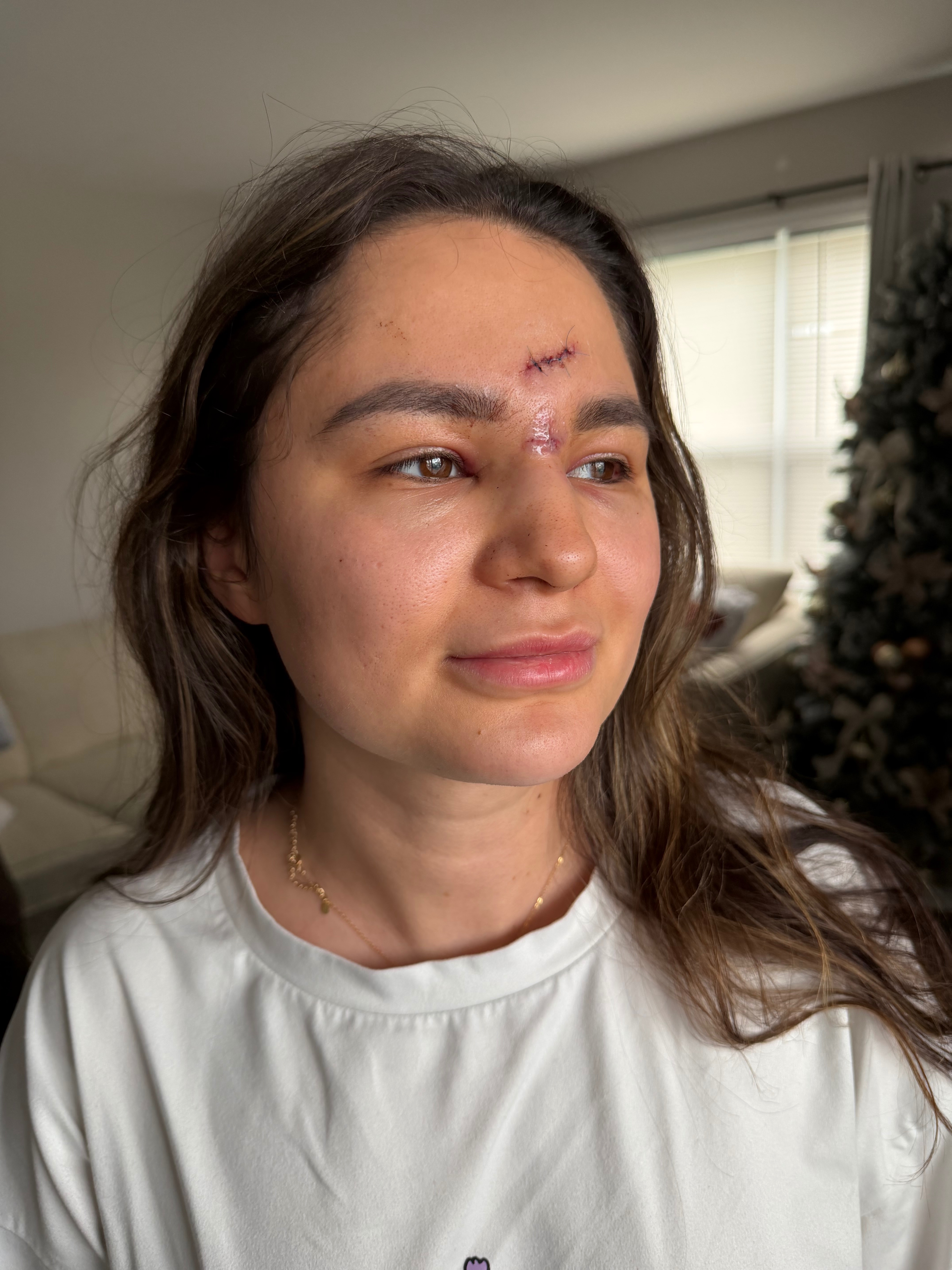 Support Daniela's Friend After Injury campaign photo, 4 of 8