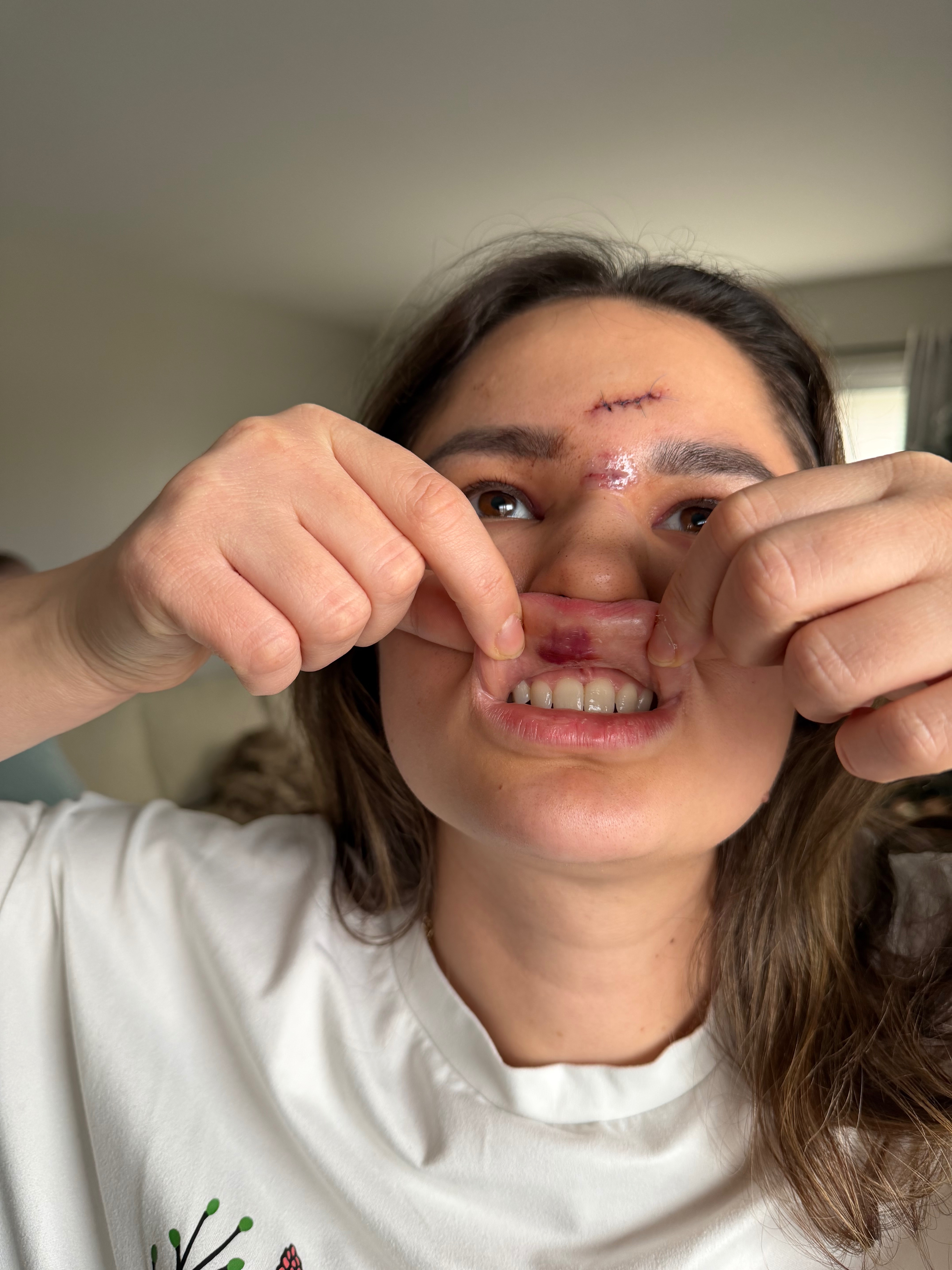 Support Daniela's Friend After Injury campaign photo, 5 of 8