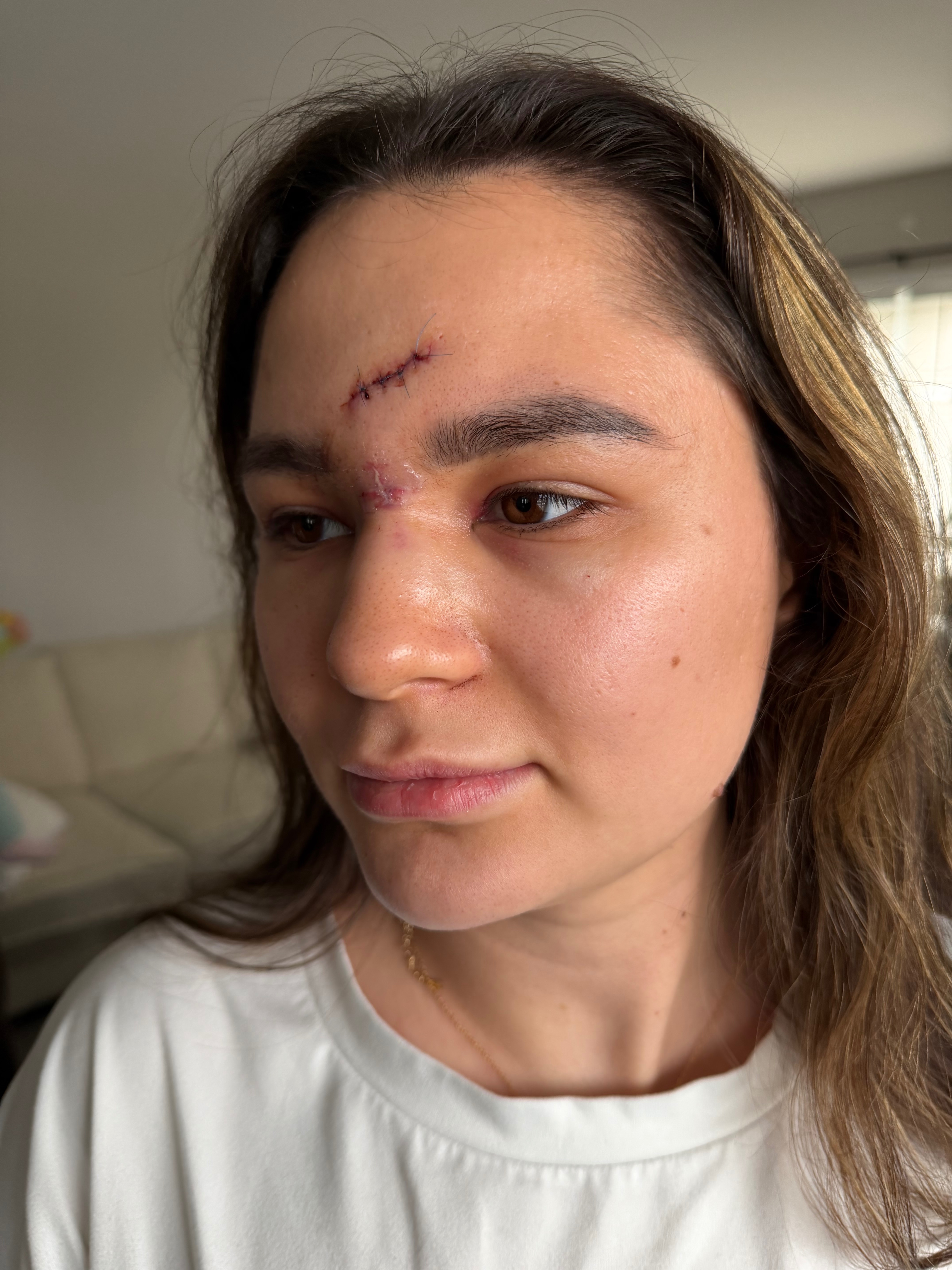 Support Daniela's Friend After Injury campaign photo, 6 of 8