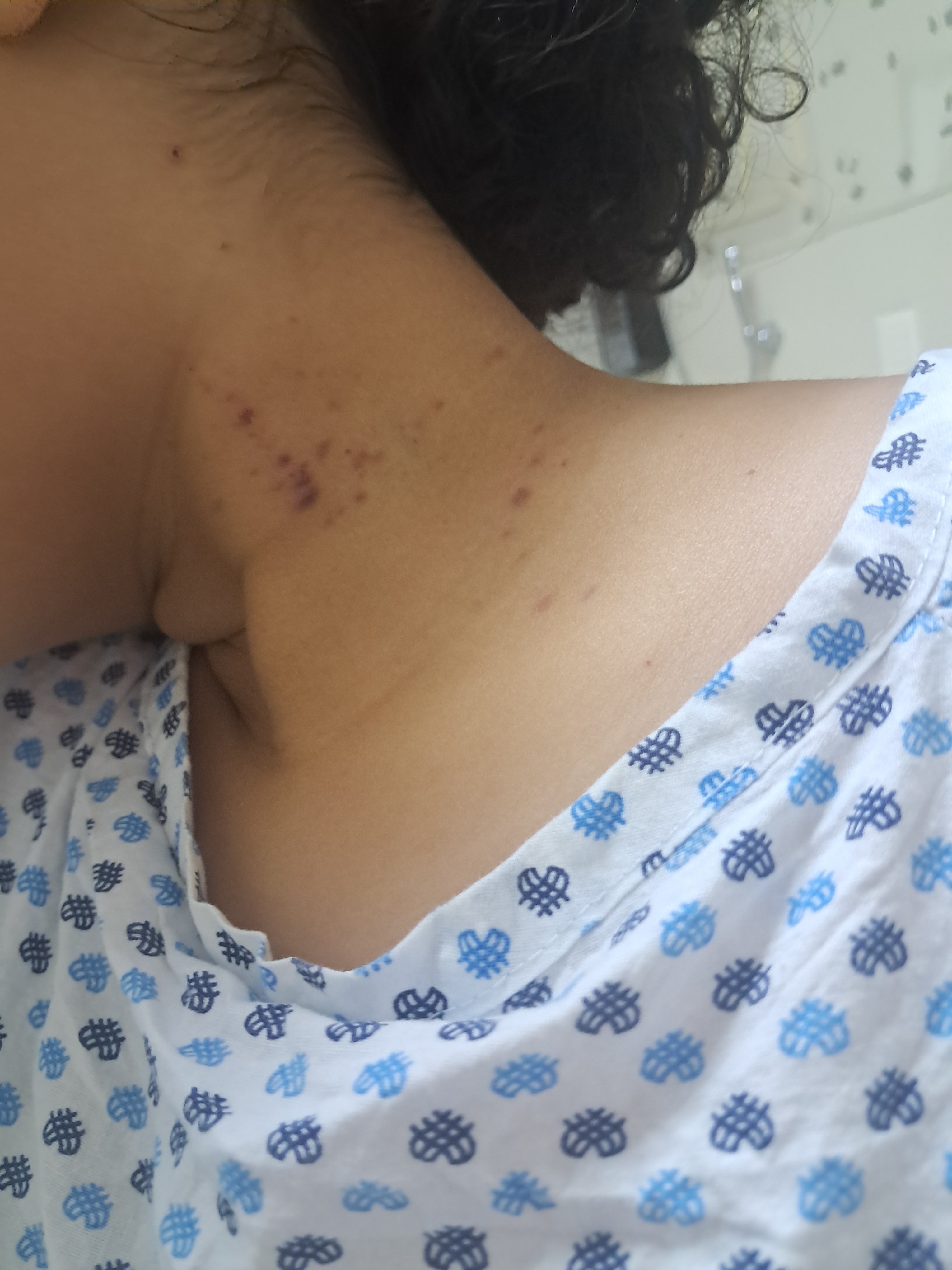 Transplante de medula osea leucemia (LLA) campaign photo, 2 of 7
