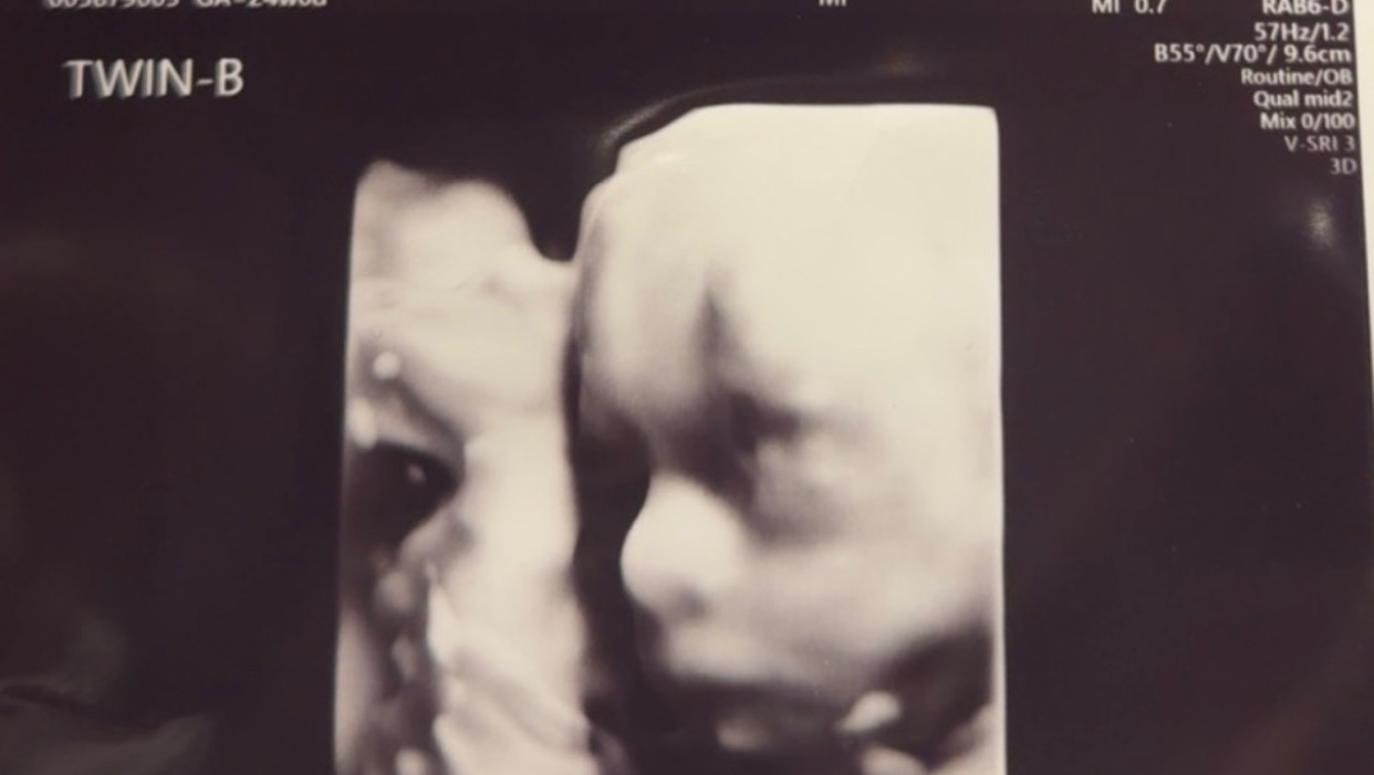 Prayers and Support for Beverly's Twin Boys