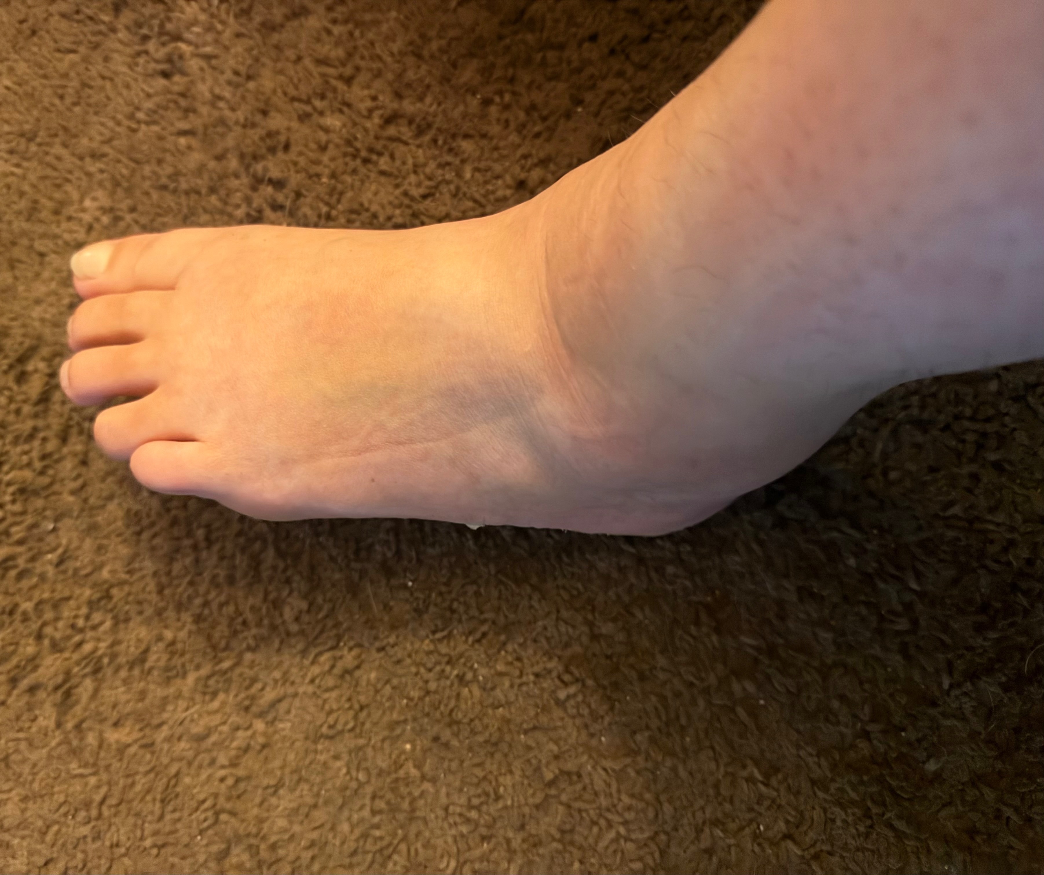 Help Alexandrea get back on her feet campaign photo, 5 of 6