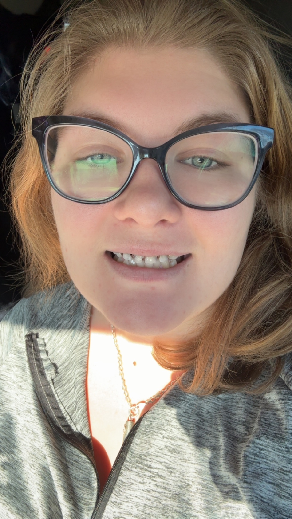 Help Me Heal From Severe Dental Pain campaign photo, 2 of 8