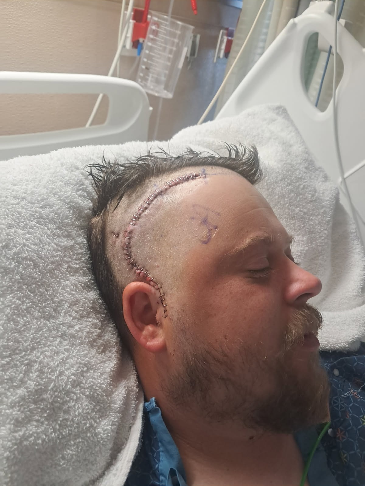Support Brian’s Fight Against Brain Cancer campaign photo, 2 of 8