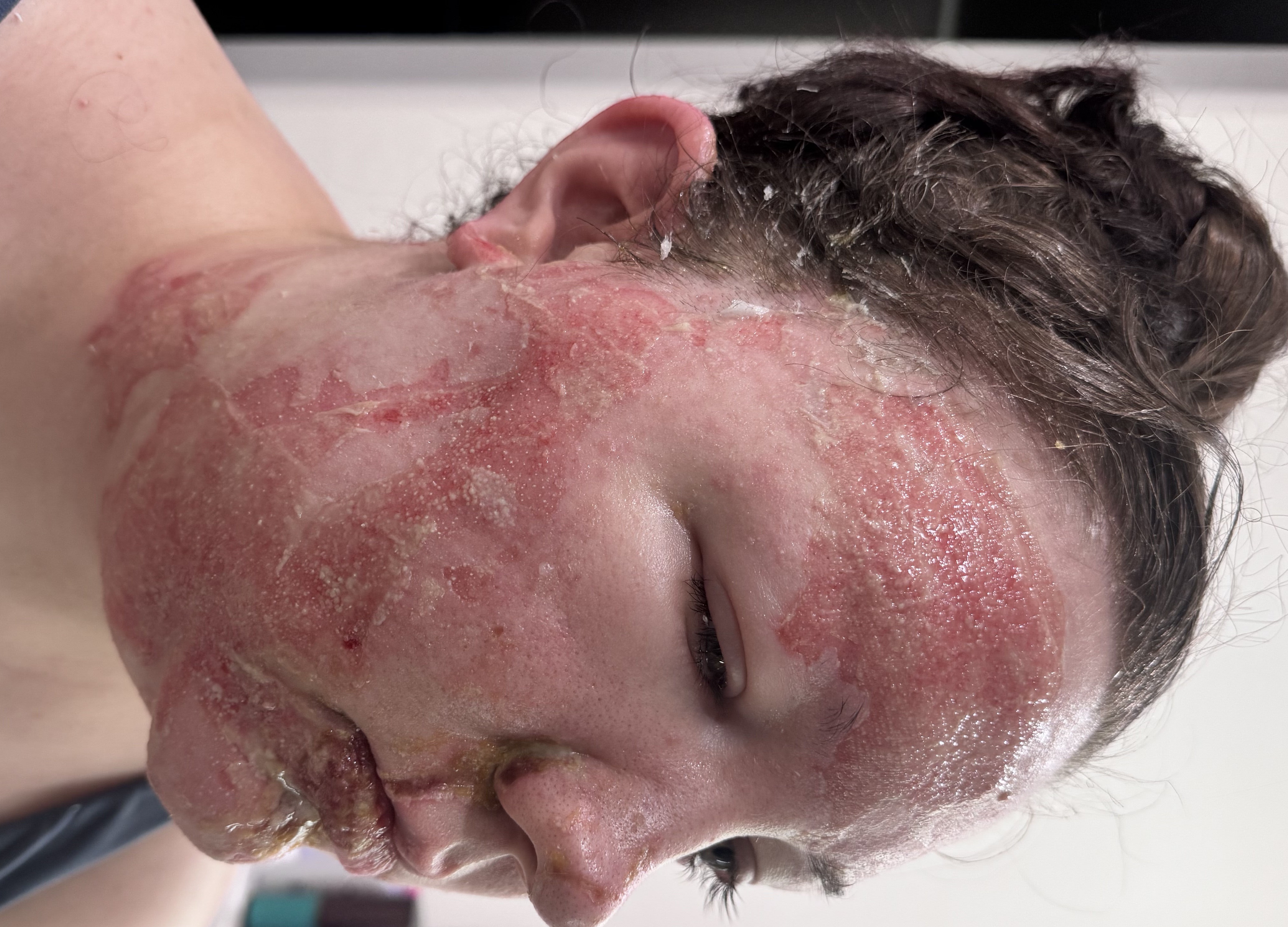 Help Kalia and Kyle Through This Tough Time campaign photo, 2 of 8