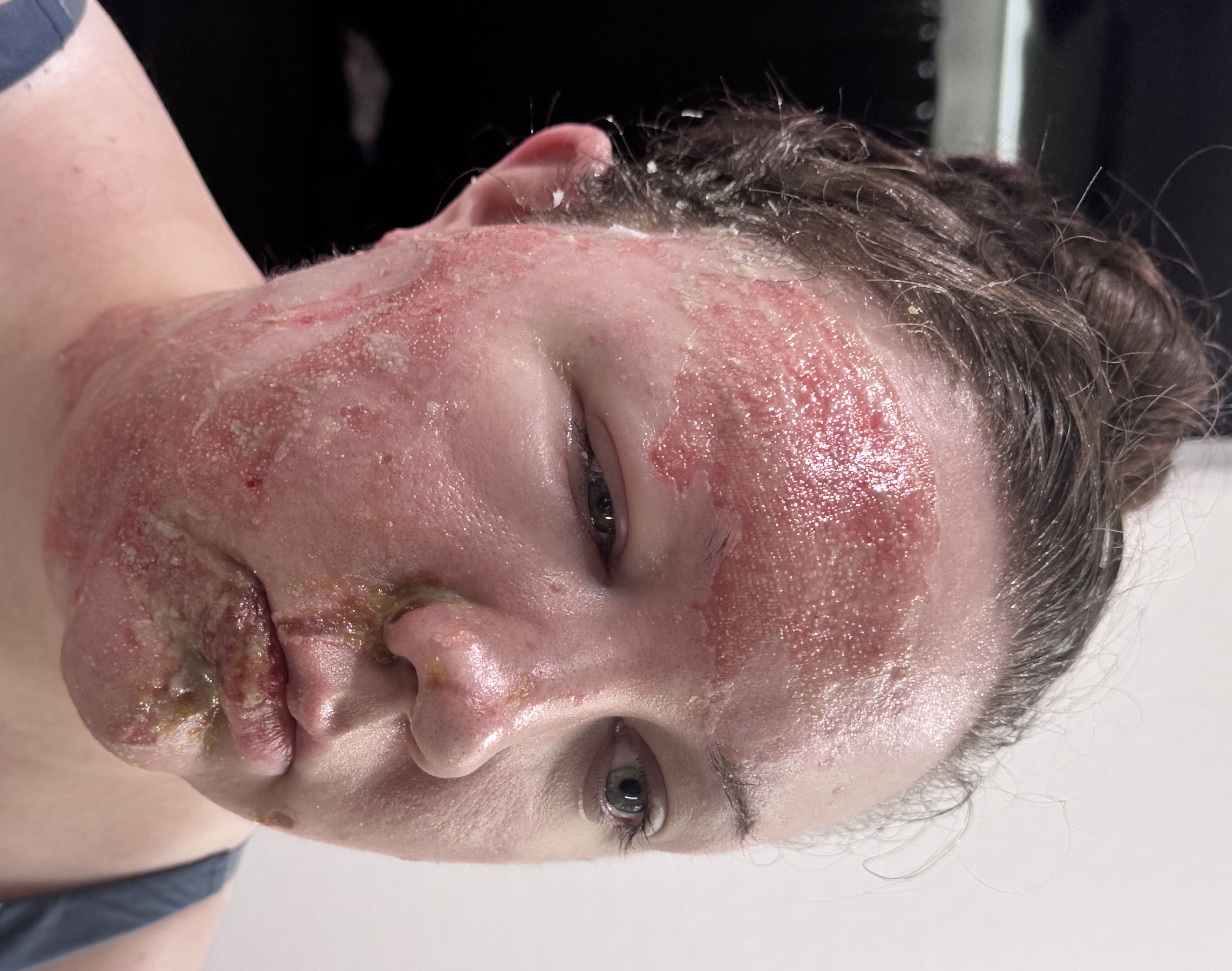 Help Kalia and Kyle Through This Tough Time campaign photo, 4 of 8