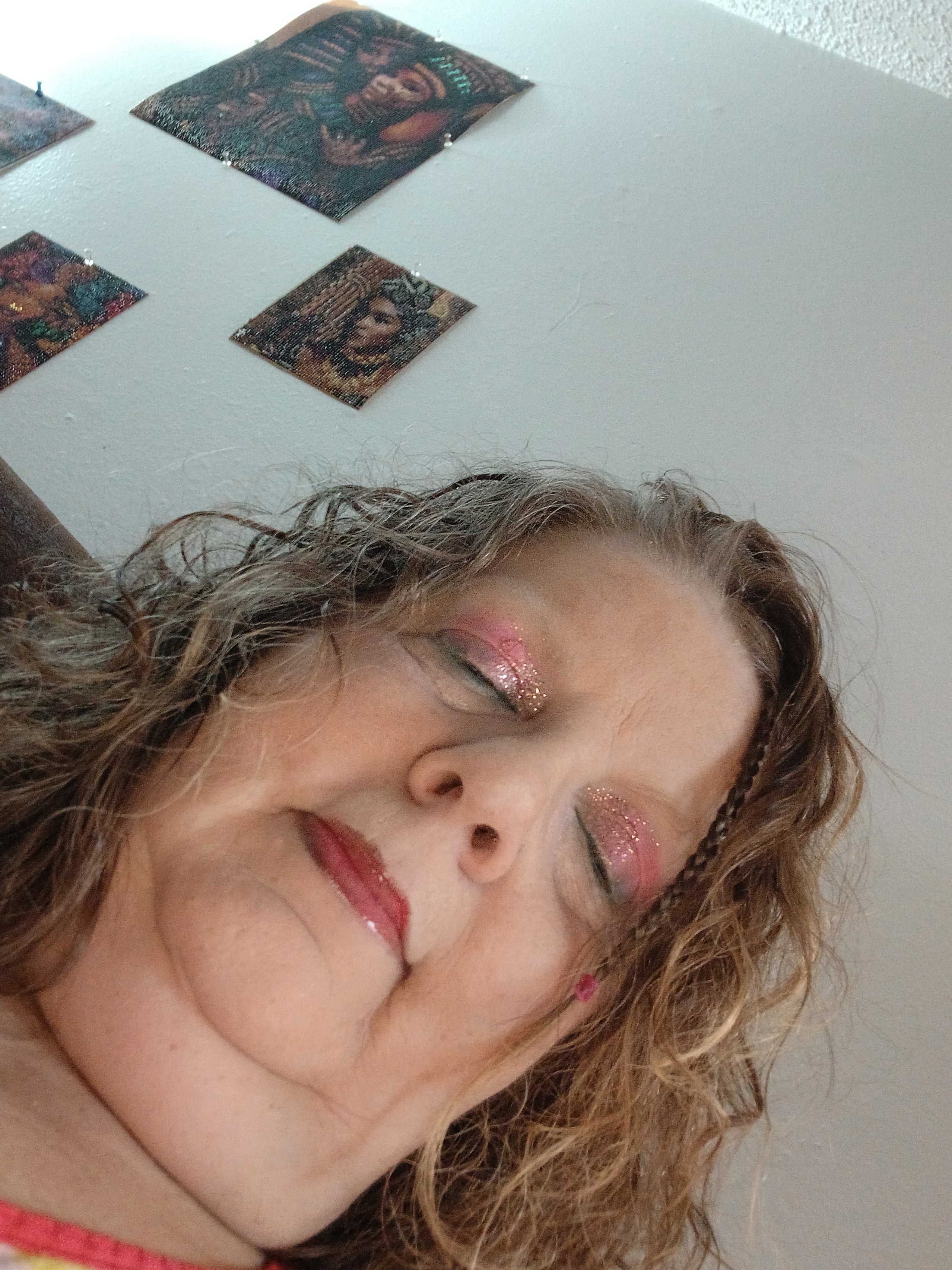 Belinda’s Journey to Life-Changing Surgeries campaign photo, 6 of 7