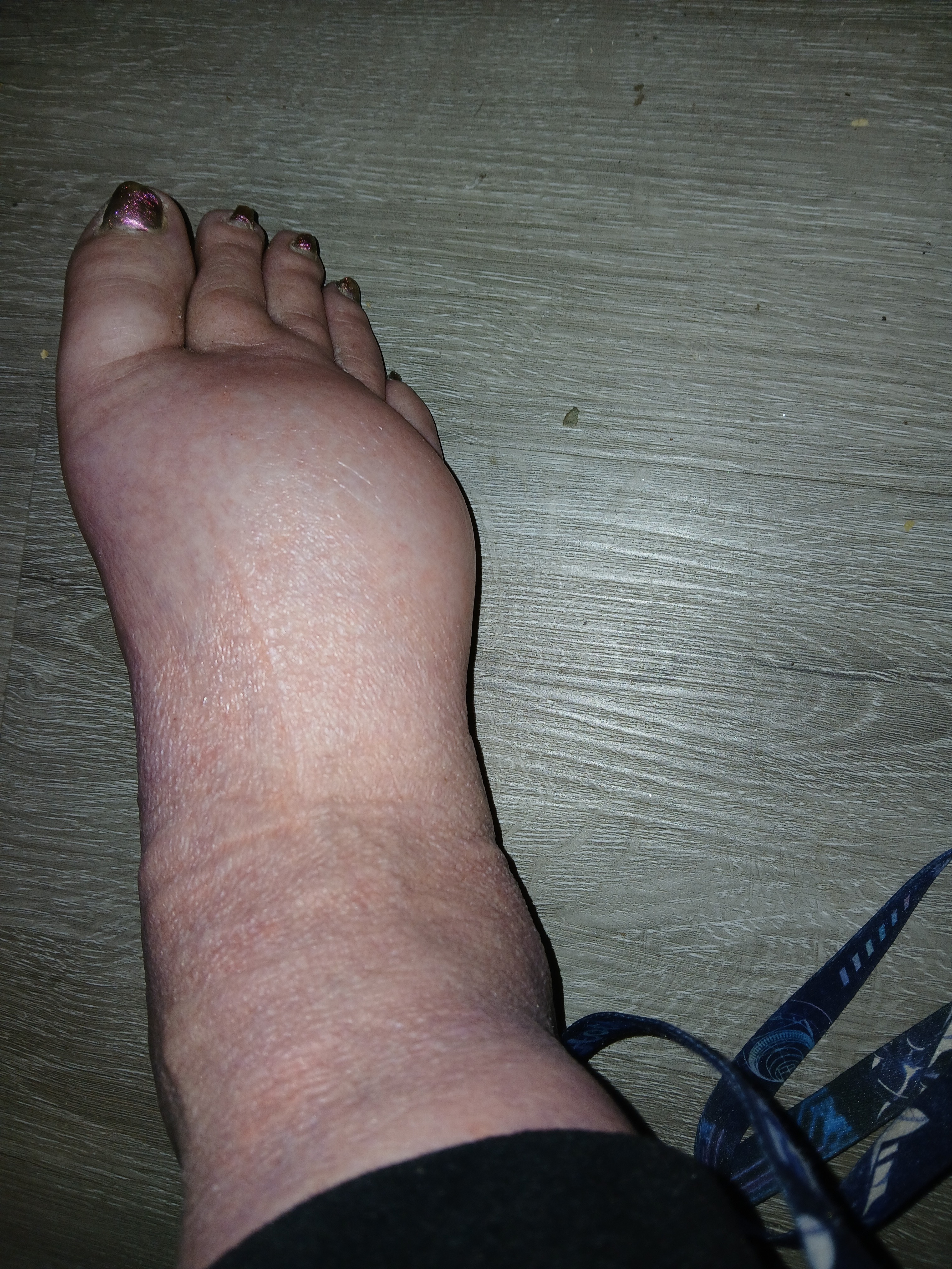 Belinda’s Journey to Life-Changing Surgeries campaign photo, 5 of 7