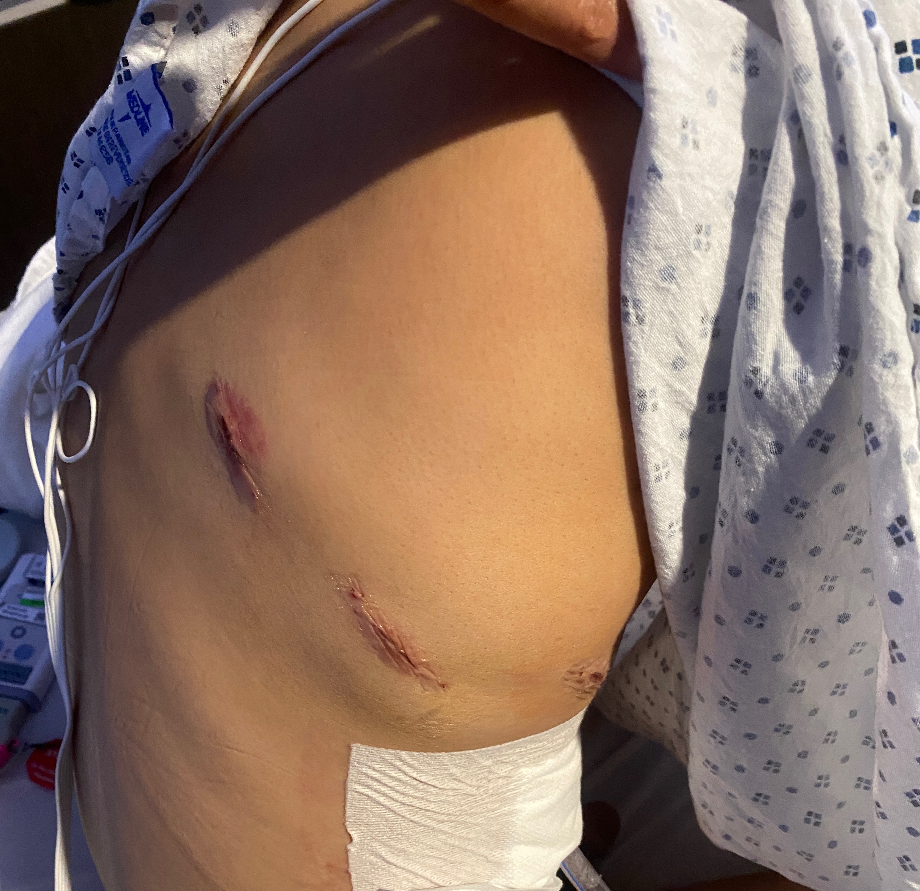 Support Tishawn’s Recovery After Lung Surgery campaign photo, 5 of 6