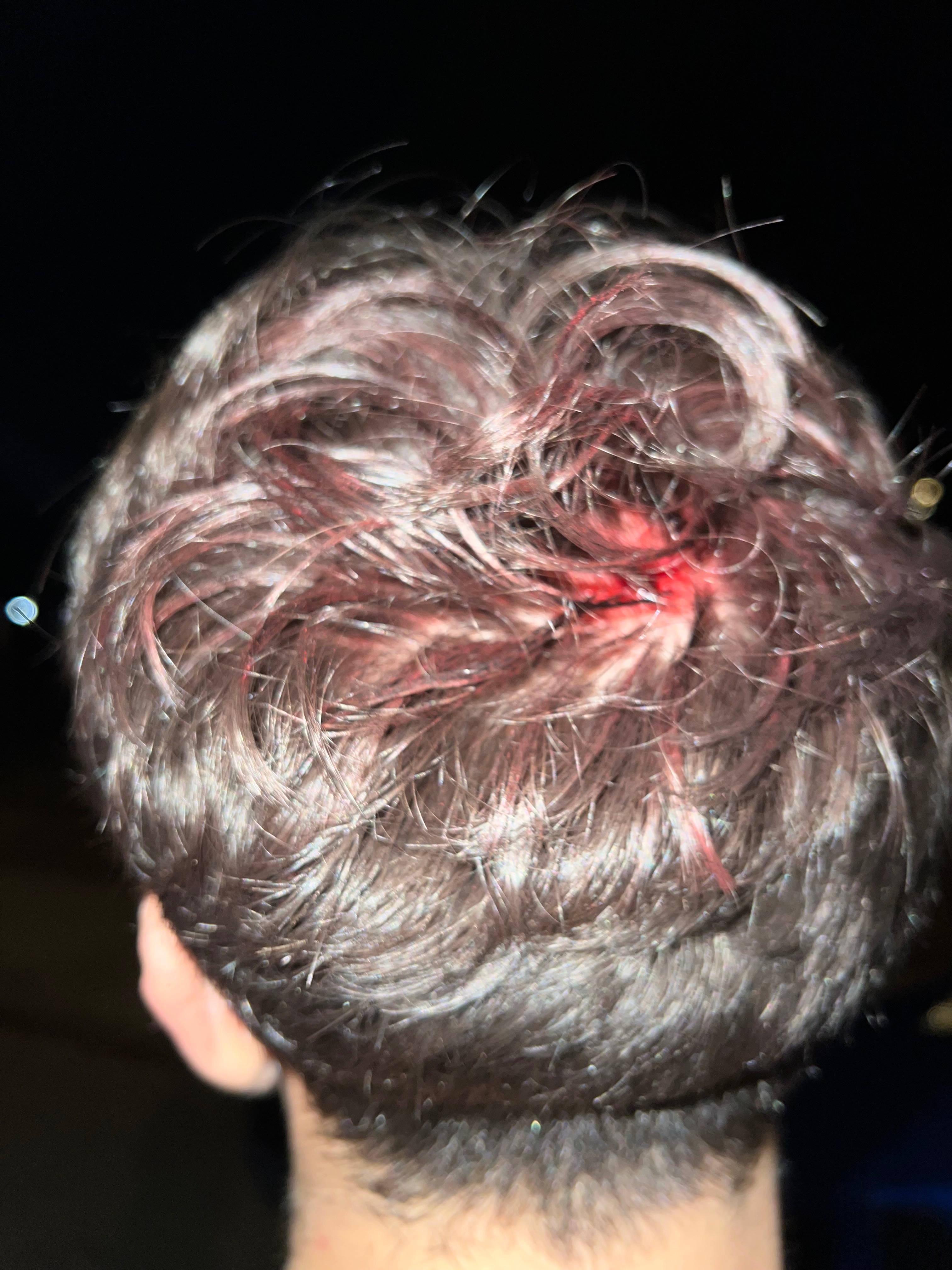 Help Jesse Pay 5k in Medical Bills after skateboarding fall campaign photo, 7 of 8