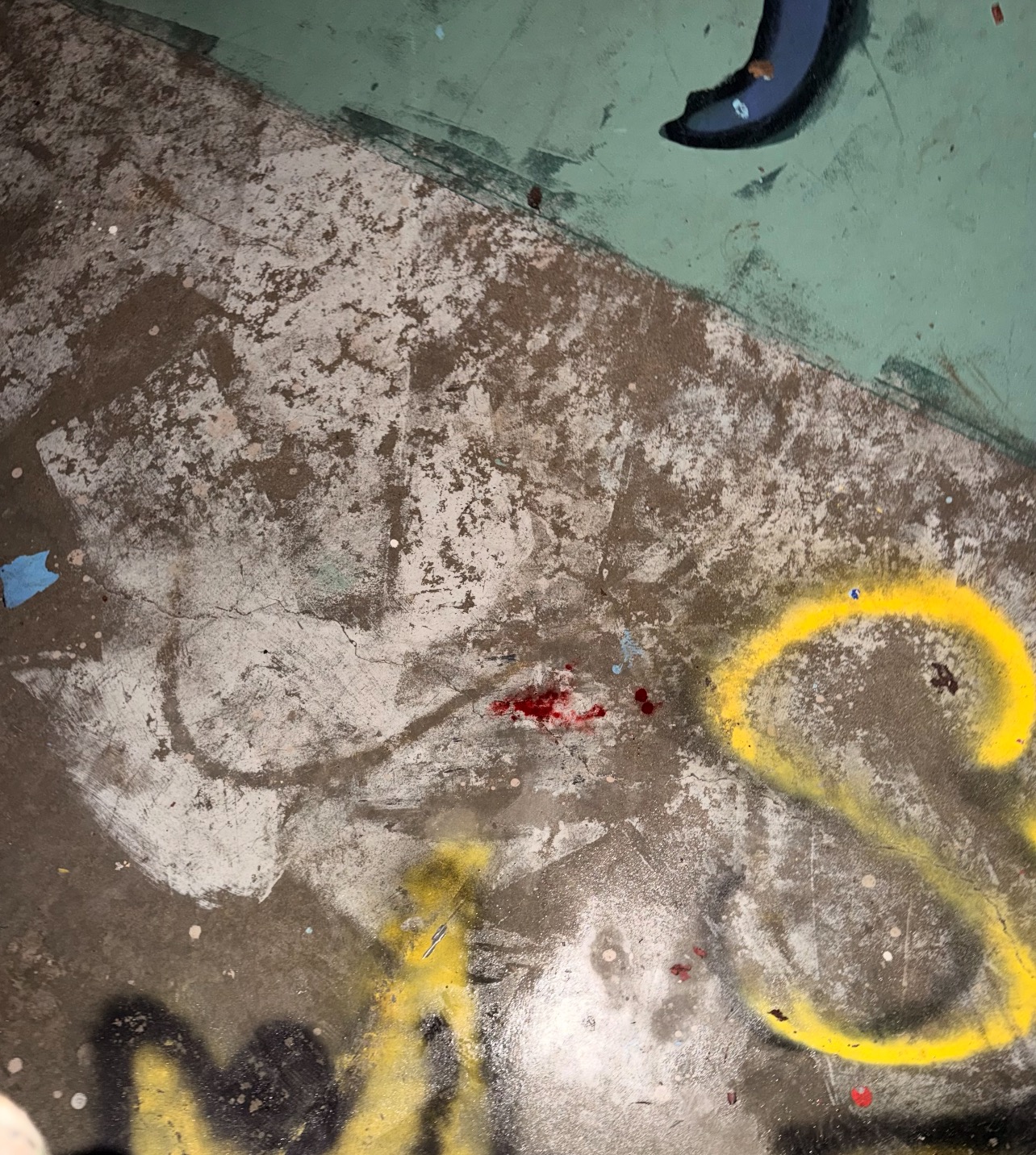 Help Jesse Pay 5k in Medical Bills after skateboarding fall campaign photo, 5 of 8