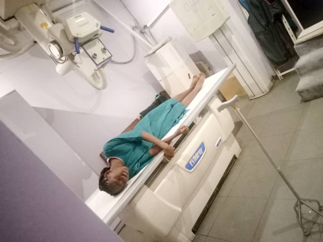 A Child Shouldn’t Live in This Much Pain....Help Yosola Walk campaign photo, 4 of 6