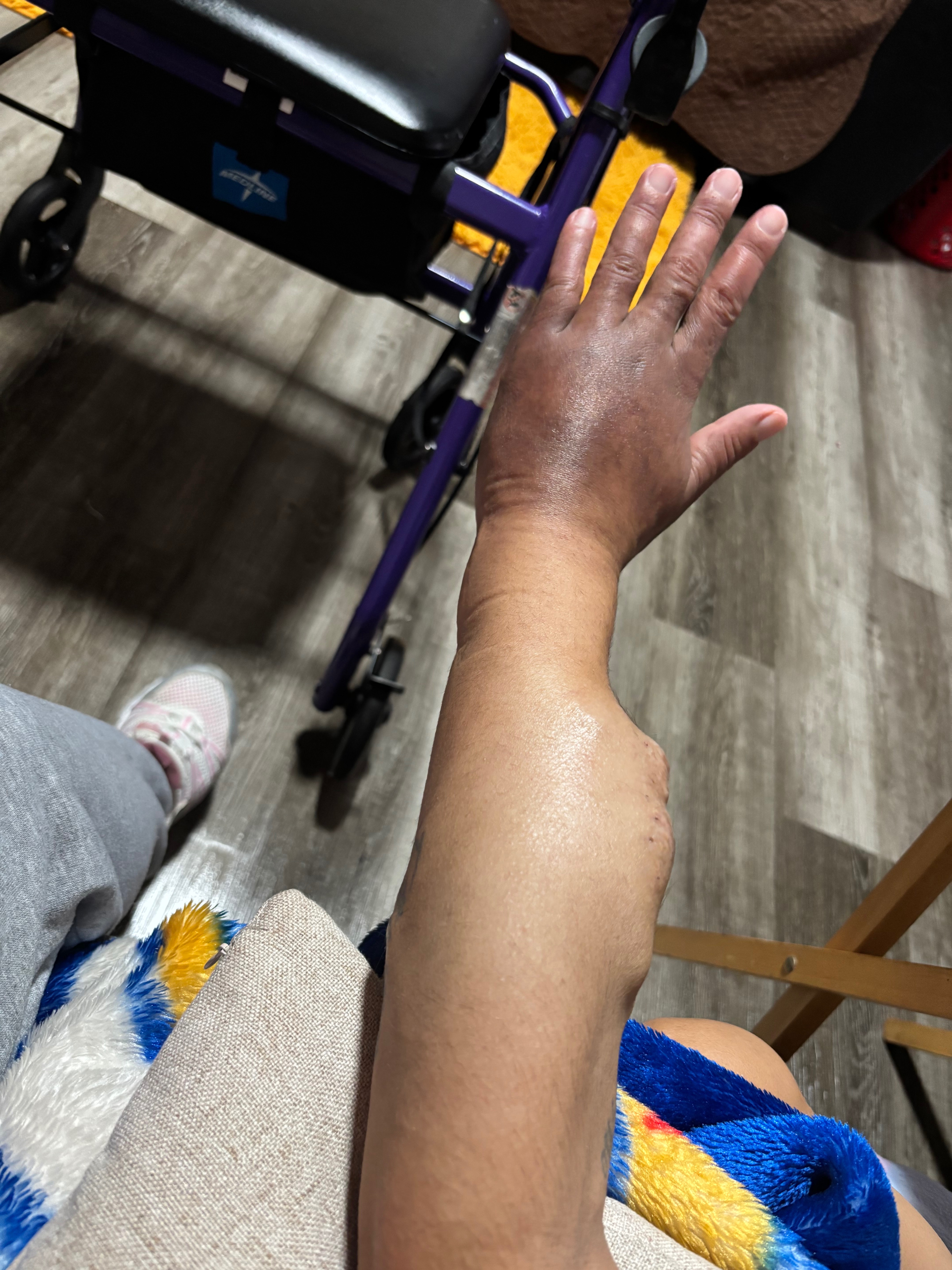 Support for Compression Gloves & Healing campaign photo, 6 of 7