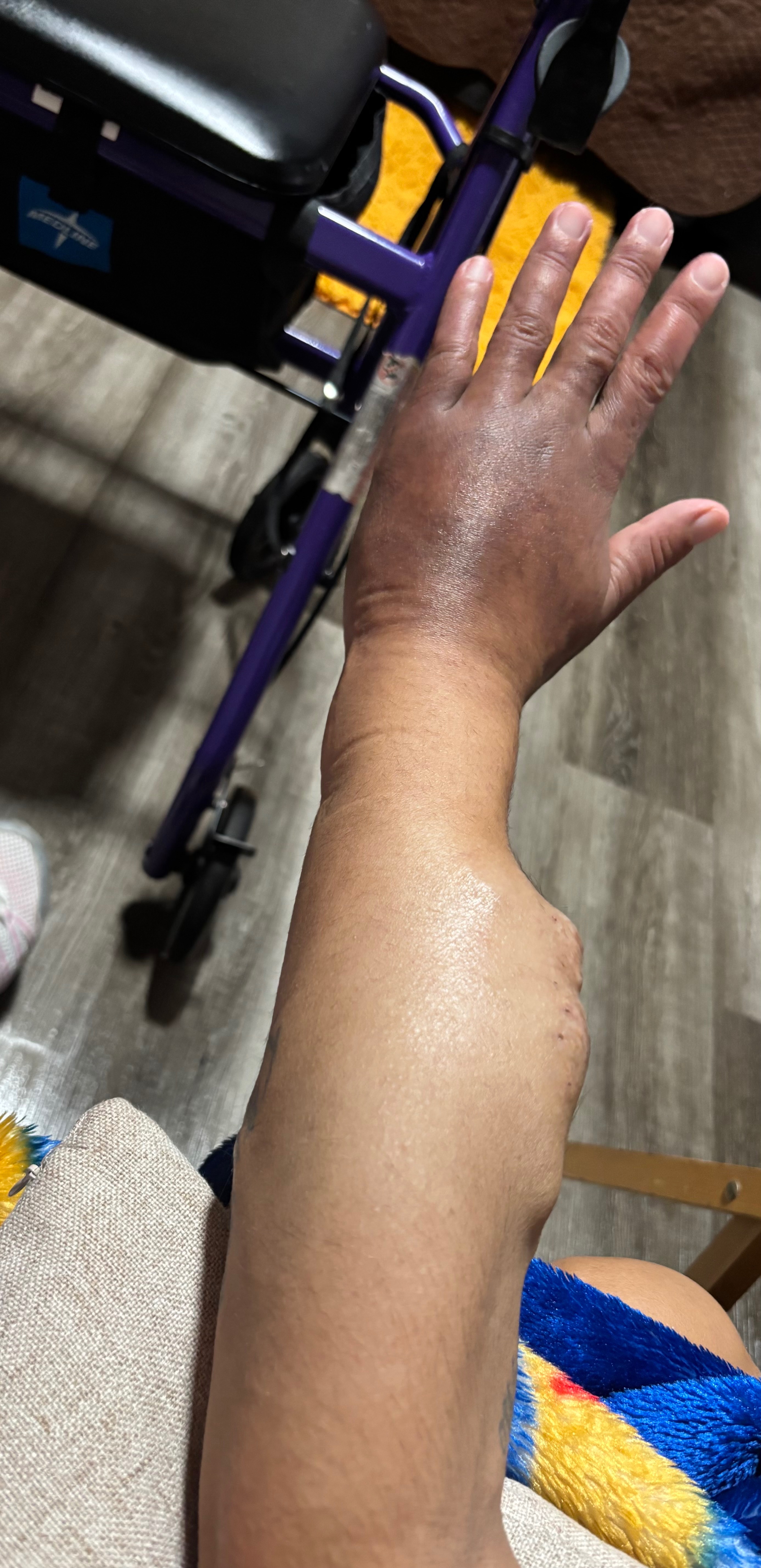 Support for Compression Gloves & Healing campaign photo, 5 of 7