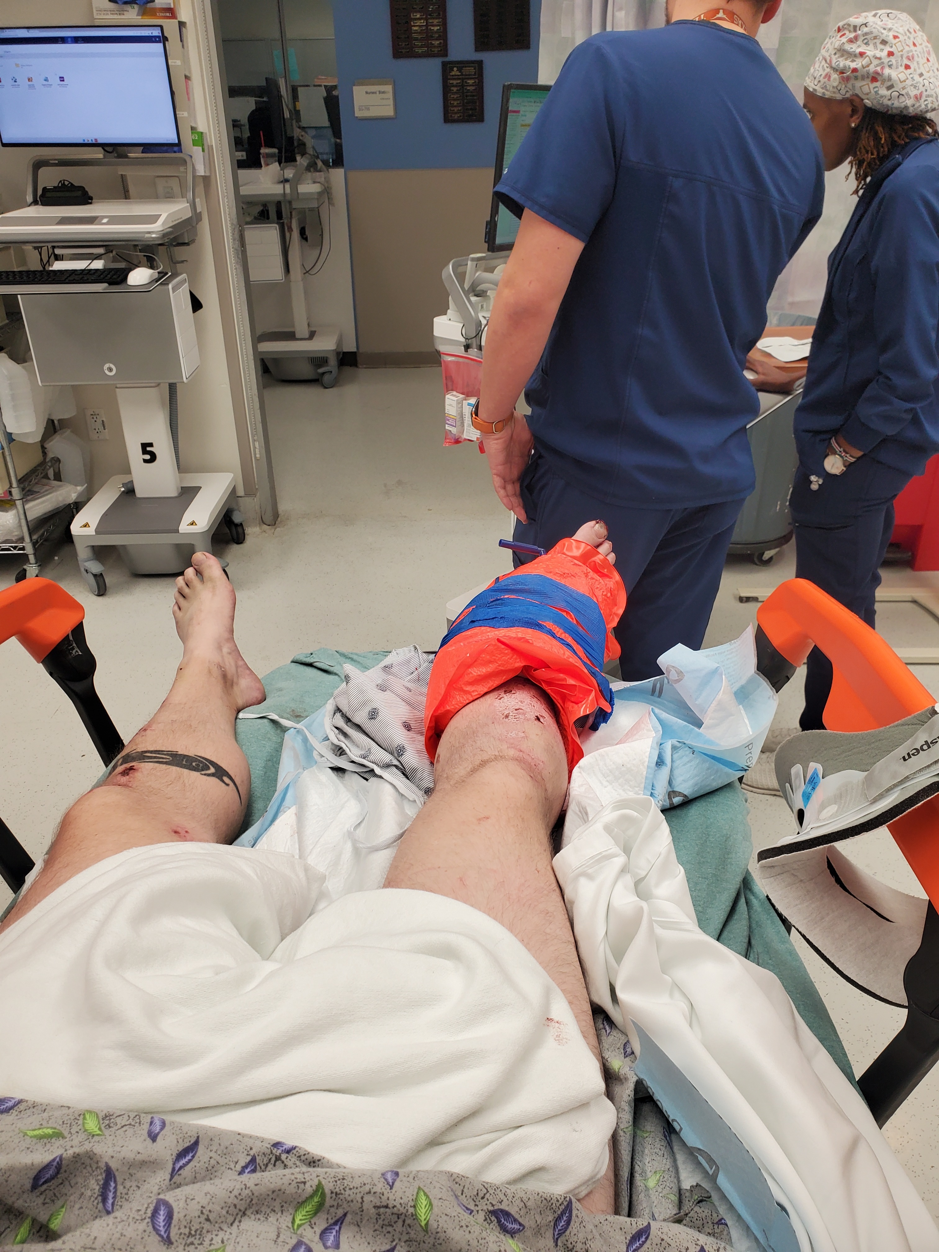 Support Chris’s Recovery After Motorcycle Accident campaign photo, 2 of 8