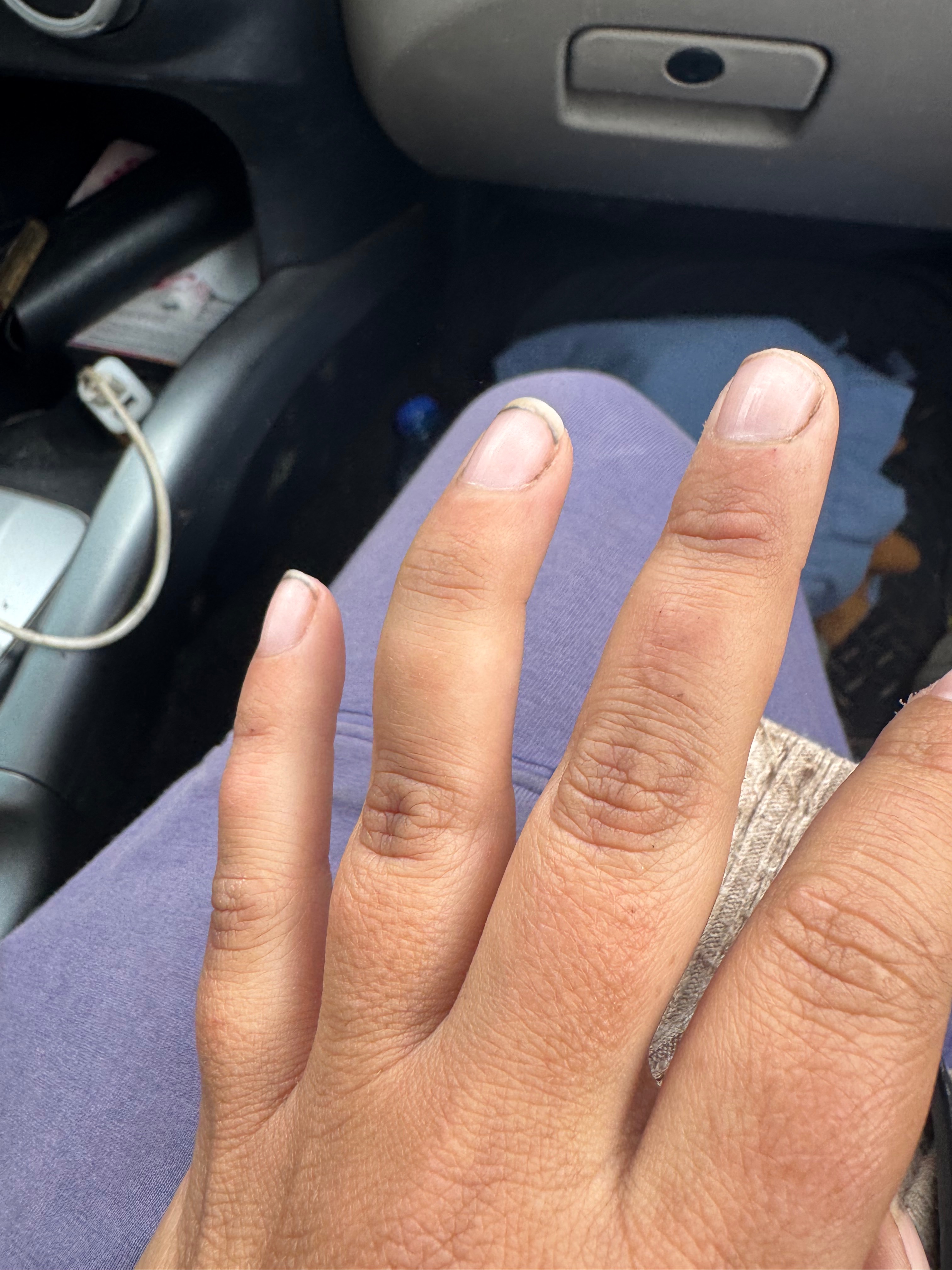 $900 SHORT Urgent Surgery Fund – Time Sensitive campaign photo, 4 of 8
