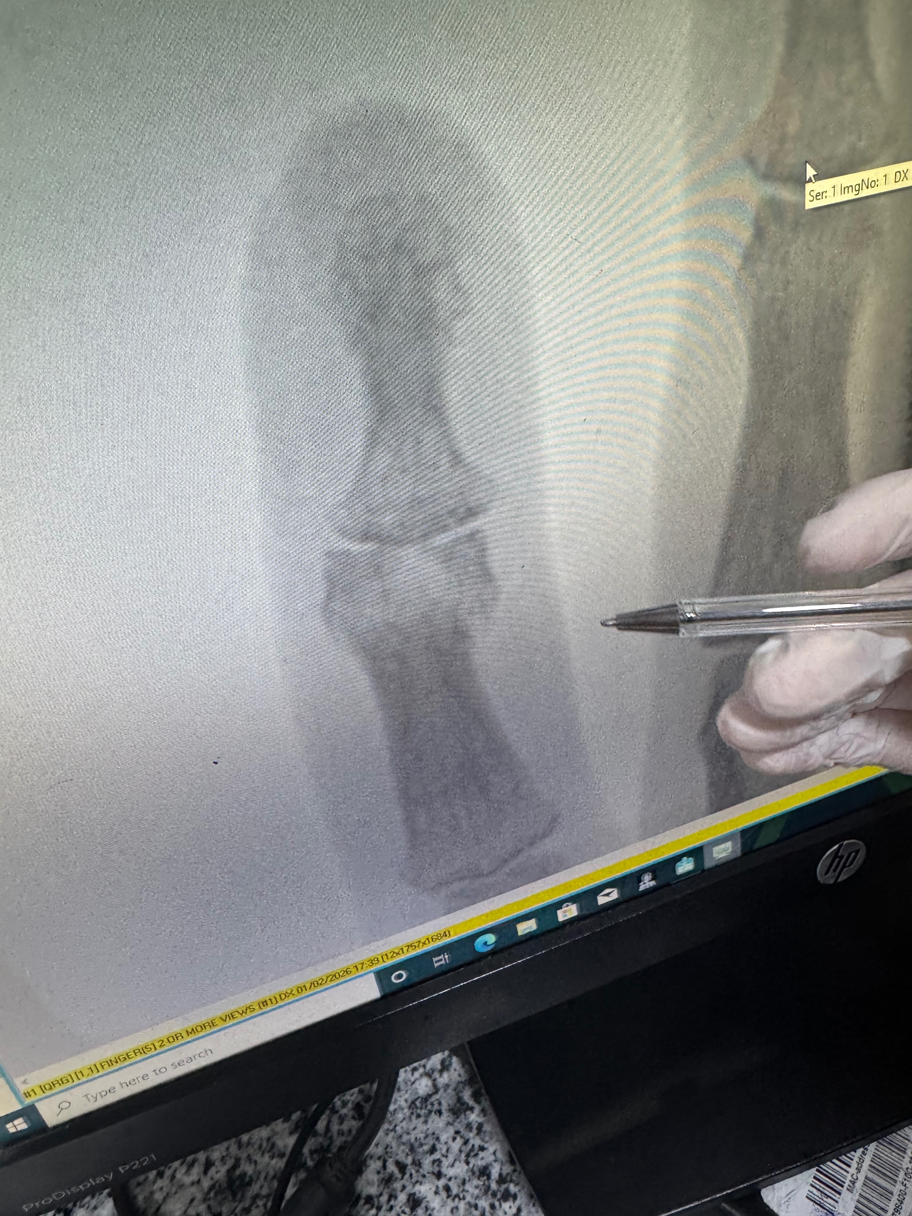 $900 SHORT Urgent Surgery Fund – Time Sensitive campaign photo, 5 of 8