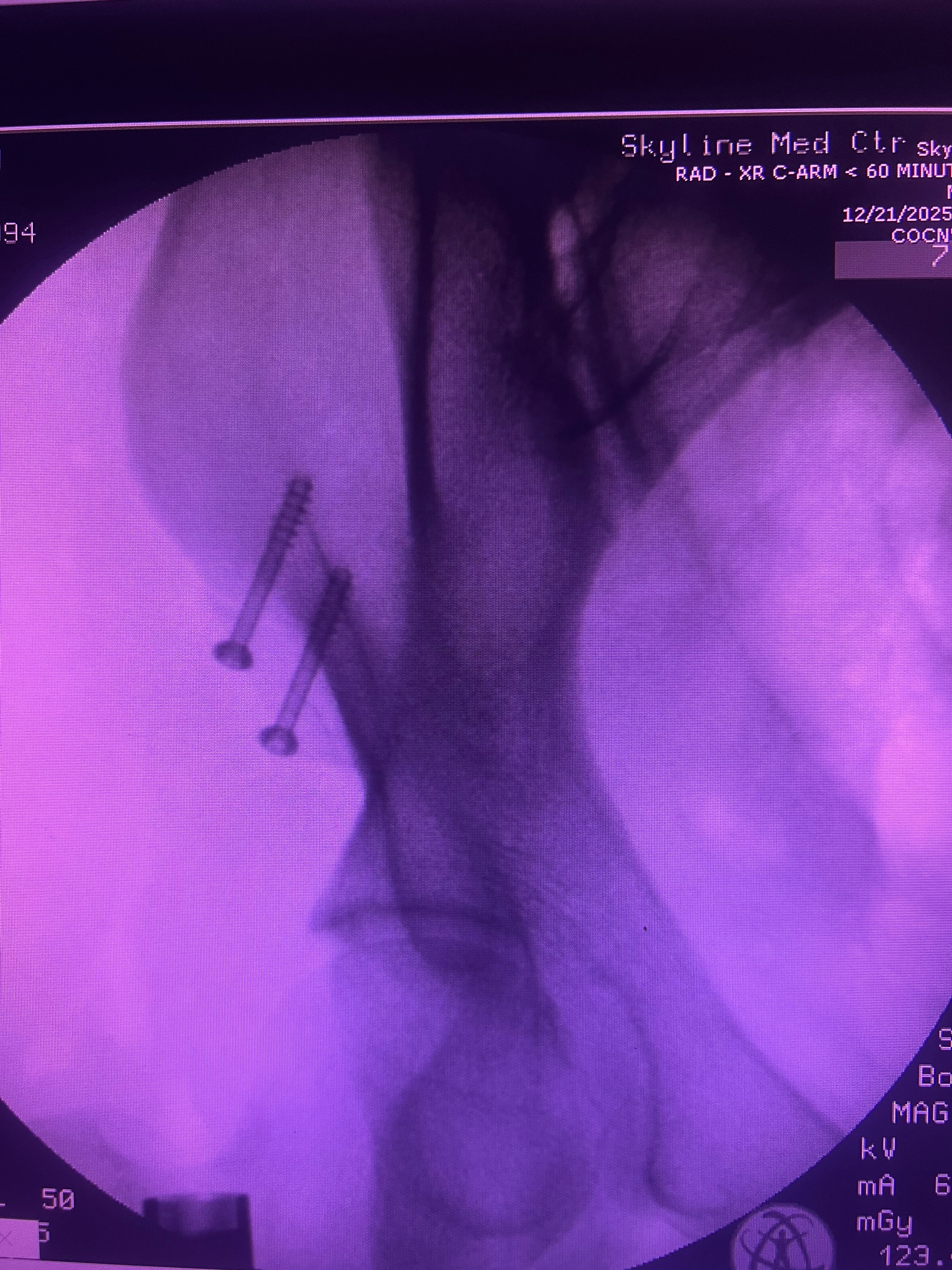 Support Josey’s Recovery After ATV Accident campaign photo, 4 of 5